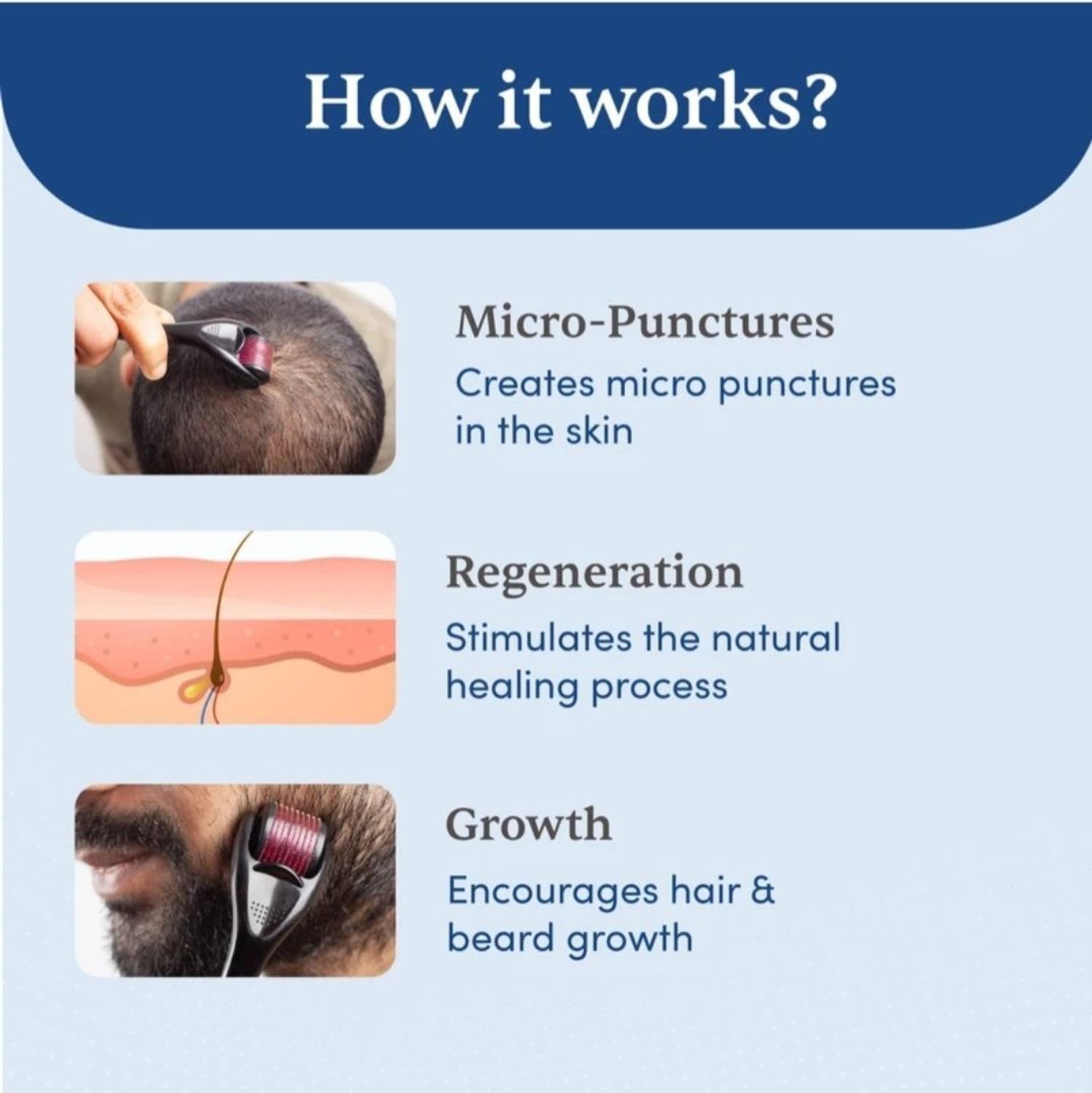 Raytrix 0.5mm Titanium 540 Micro Needles for Hair & Beard Growth - Image 2