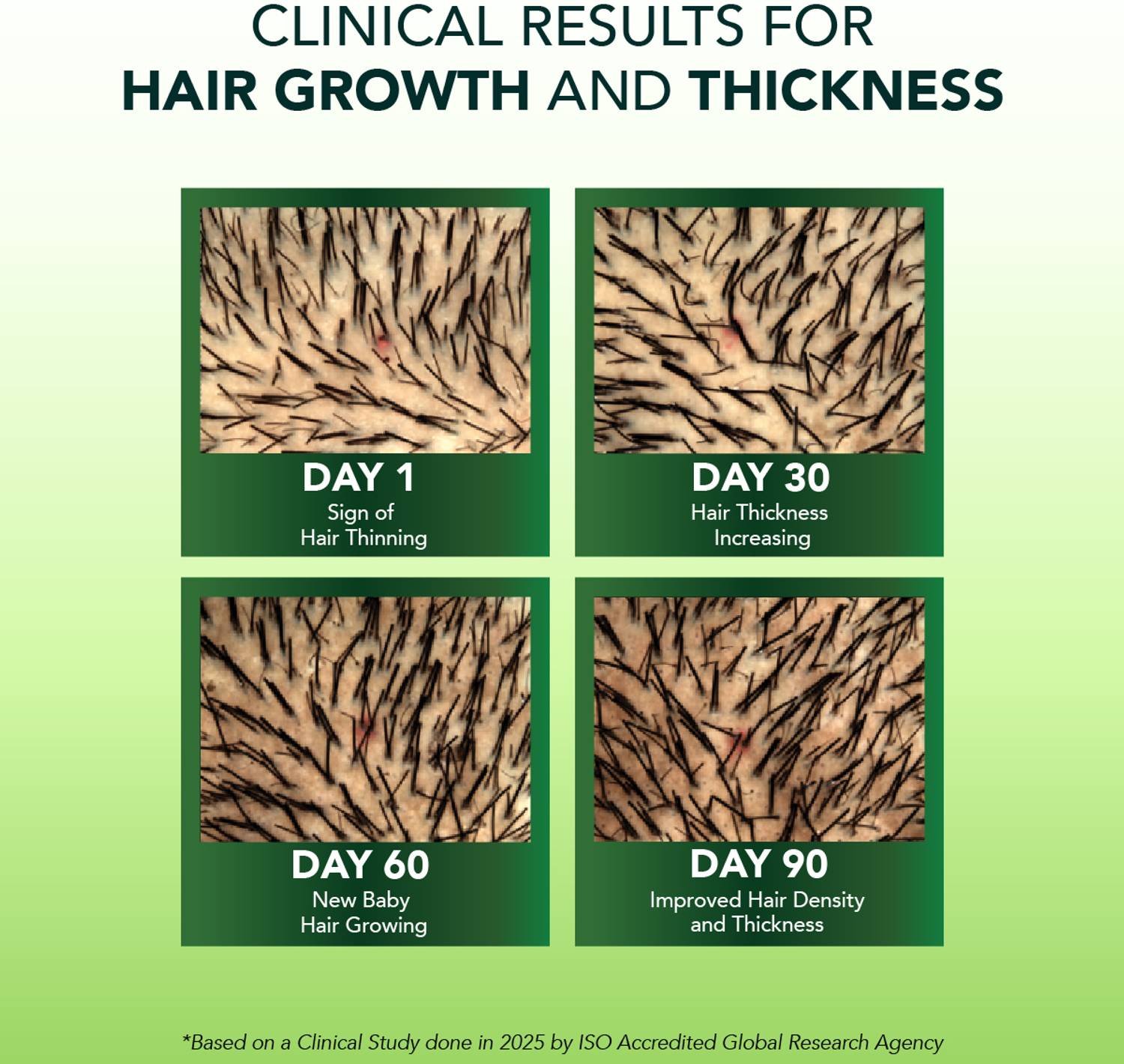 Alps Rosemary Water for Hair Growth - Image 5