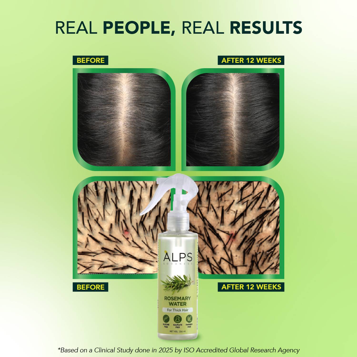 Alps Rosemary Water for Hair Growth - Image 3