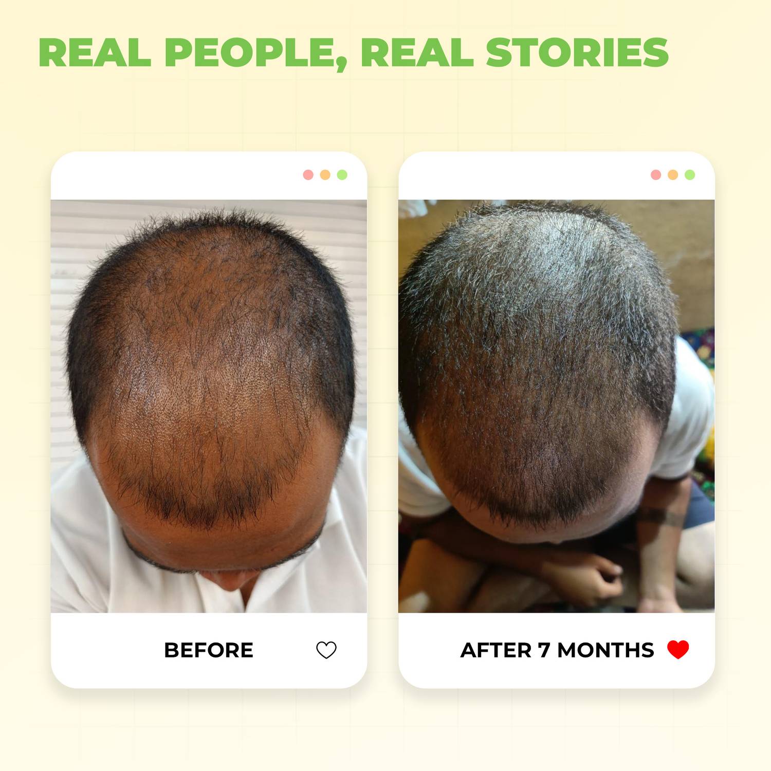 Avimee Herbal Keshpallav Hair Oil with Rosemary - Image 4