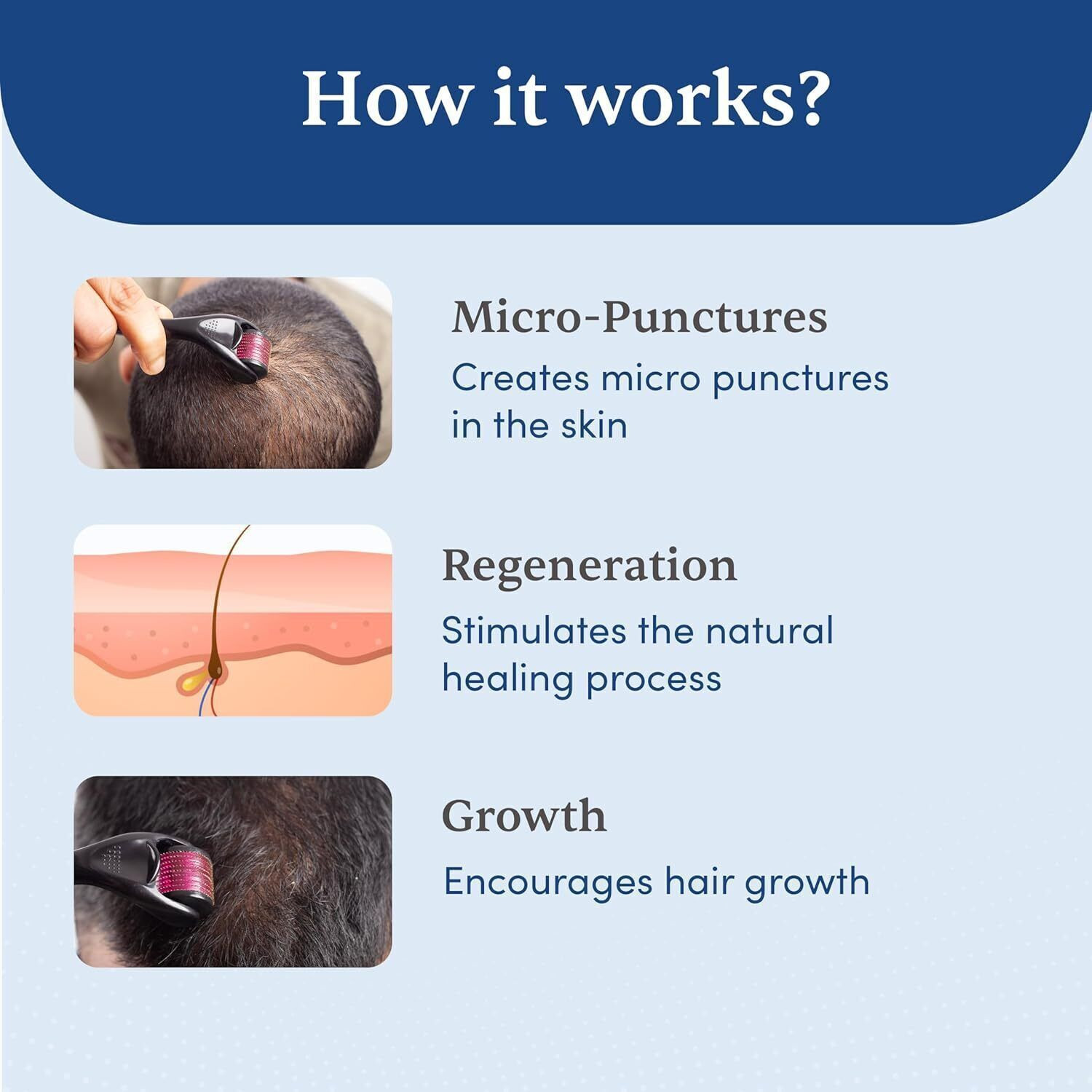 Image of UNVELIS Derma roller 0.5mm for hair & beard growth| 0.5 mm Titanium 540