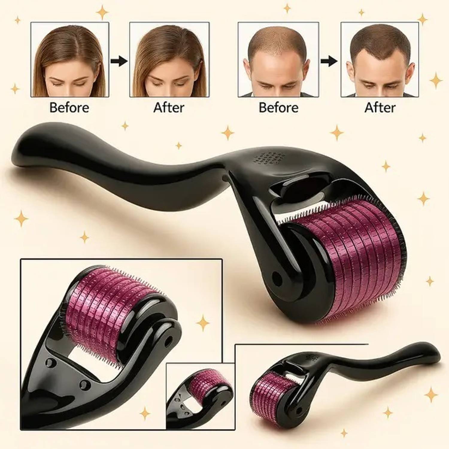 Tactile Derma Roller 0.5mm - Image 4