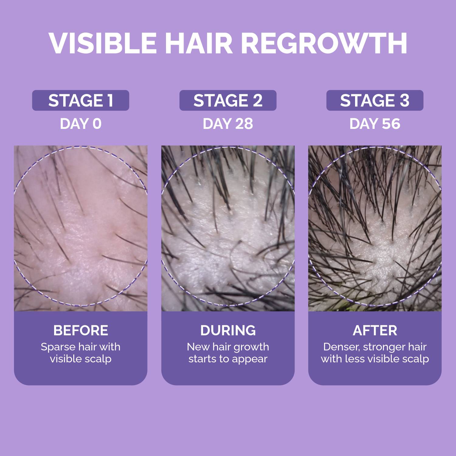 Phillox Advanced Hair Growth Spray 3% Redensyl - Image 3