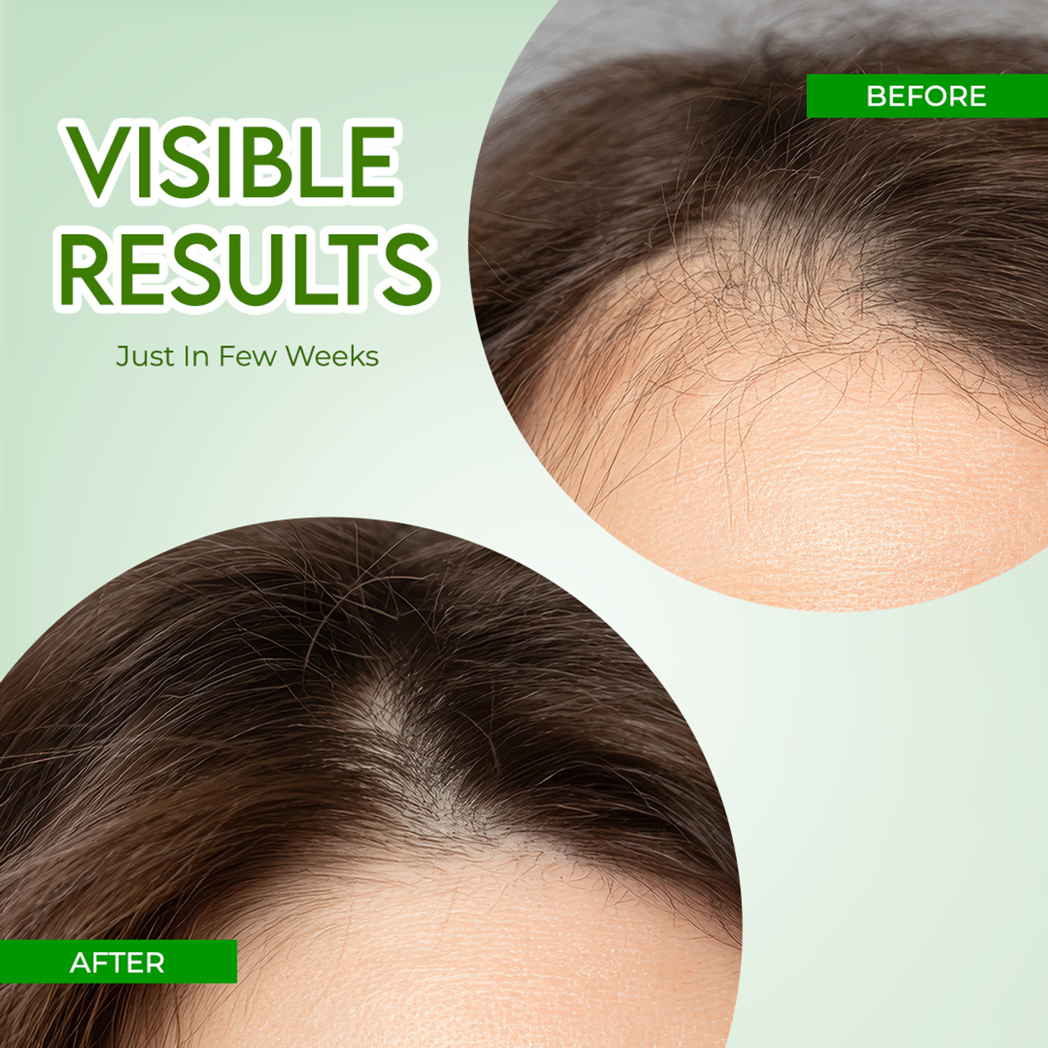 Image of Arka glow Alpex Rosemary Water | Rosemary water for hair | Hair Spray for Hair Growth