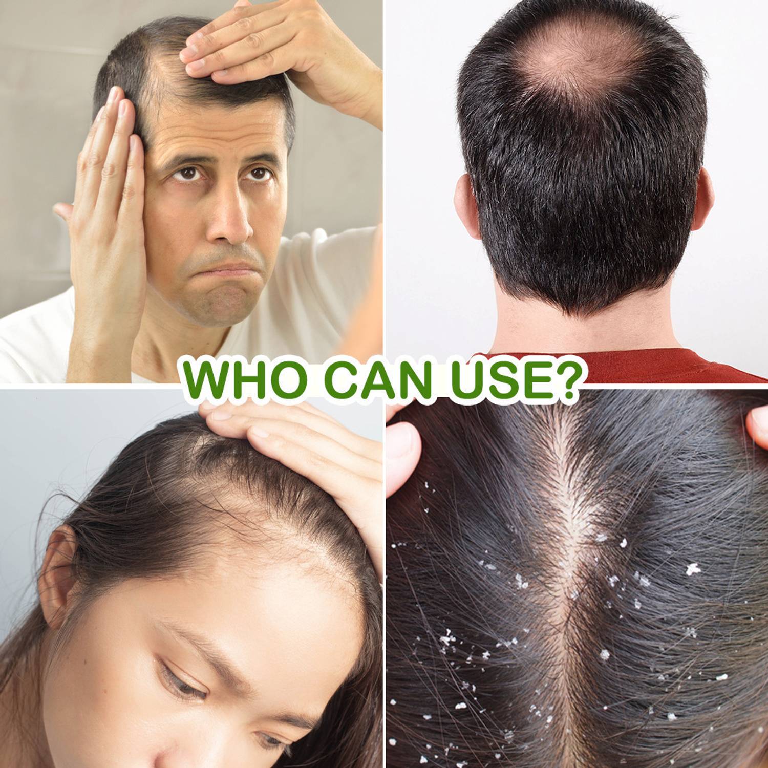 Jovees Rosemary Water Spray for Hair Growth - Image 5