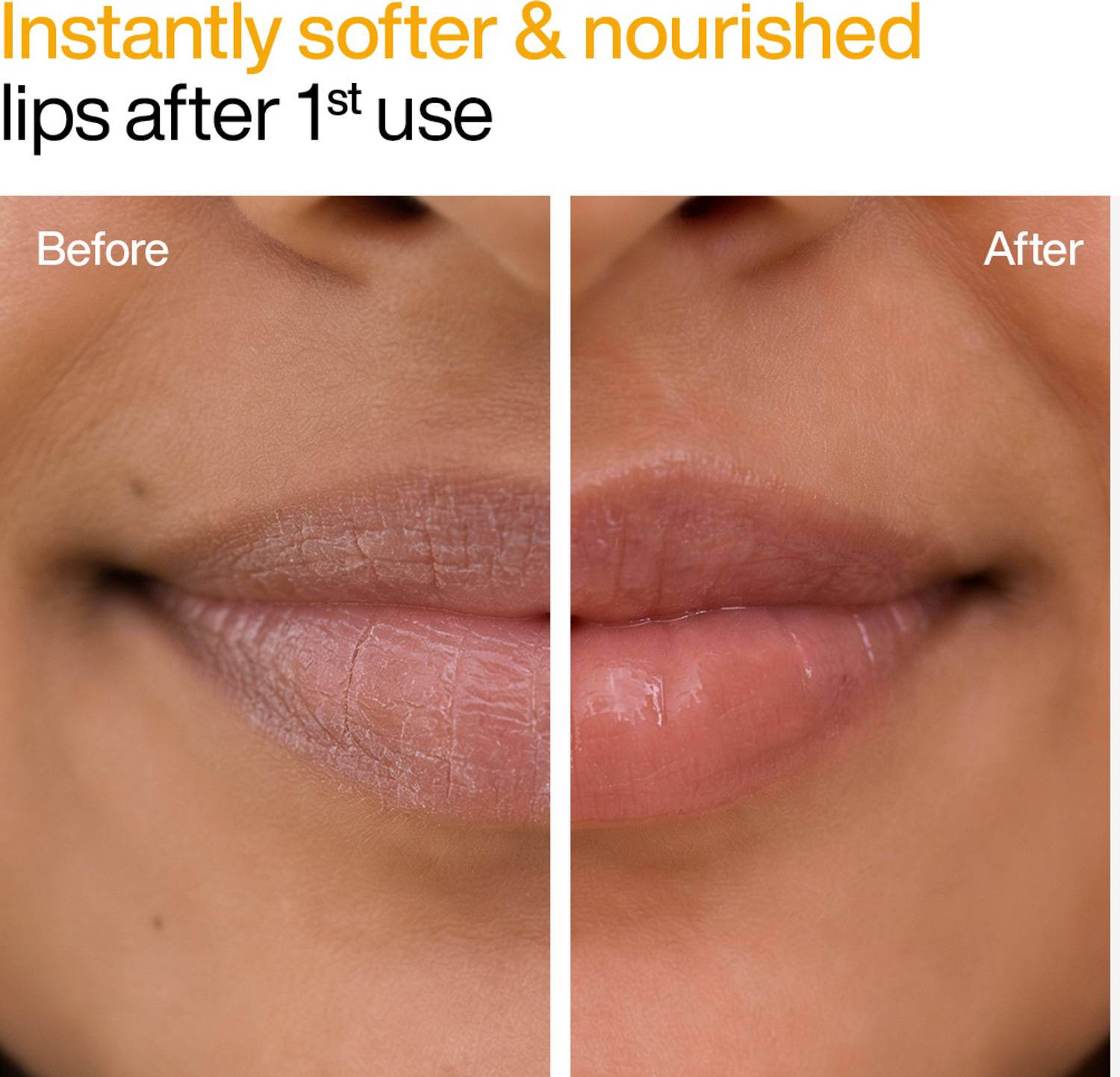 WishCare Ceramide Lip Balm SPF50 PA+++ - Image 5