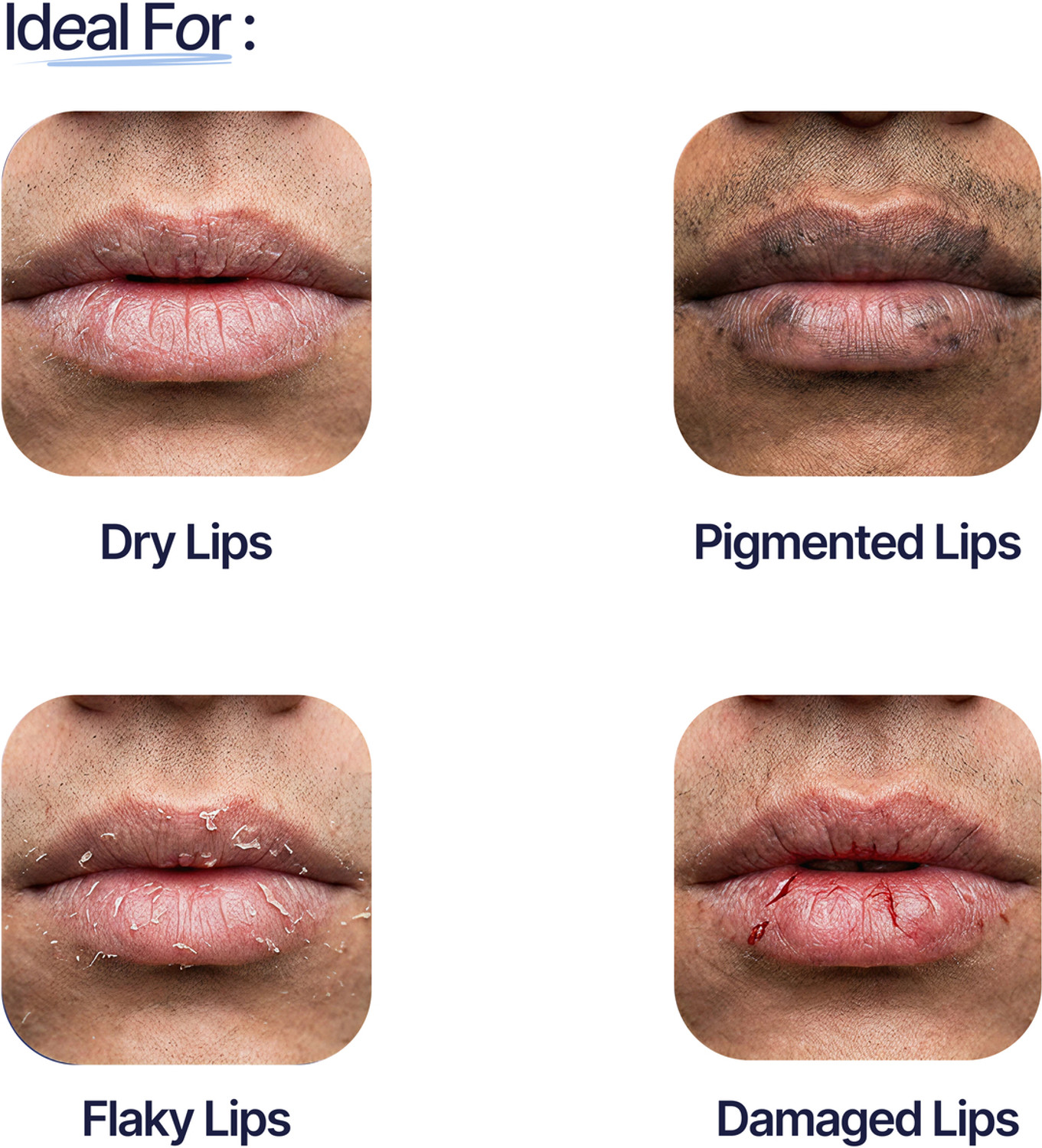 Image of Mannlich Lip Brightening Balm for Dark Lips | SPF 50, 2% Kojic Acid & 1% Hyaluronic Acid Unflavored
