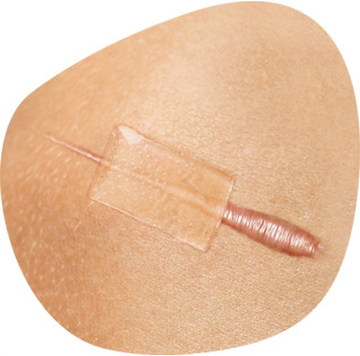 Image of smith and nephew CICA-CARE SILICONE GEL SHEET SIZE 12CMX6CM Hydrogels Medical Dressing