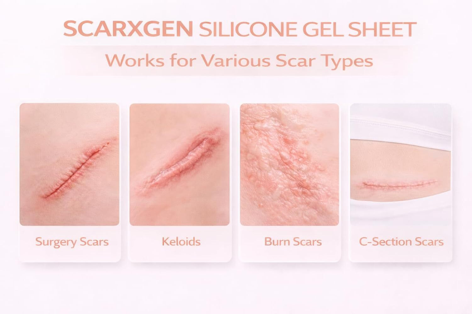 Image of SCARXGEN Silicone Gel Sheet 12cm x 6cm,Advanced Scar sheet for Surgery scar, Burn, Keloid Hydrogels Medical Dressing