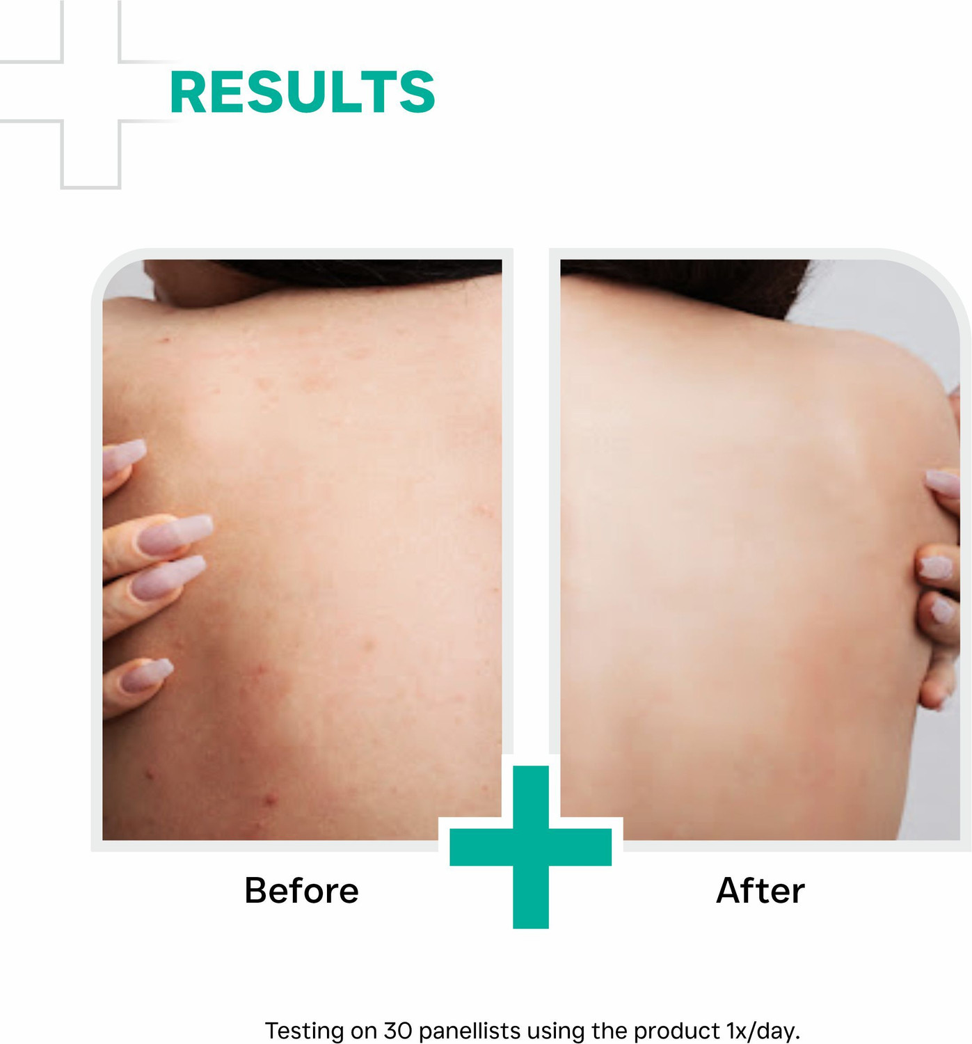 Image of Dermatouch AHA 10% BHA 1% Body Lotion for Men & Women ( 100ml PO2 )