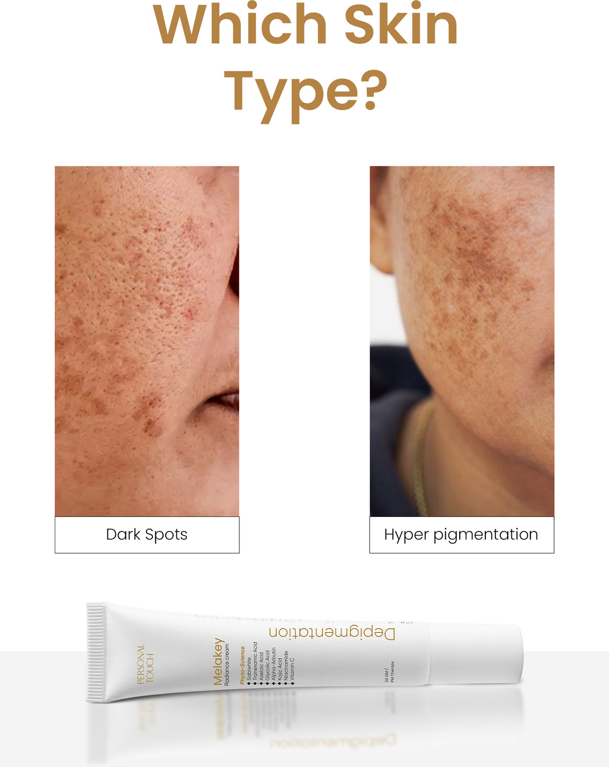 Image of PERSONAL TOUCH SKINCARE Melakey - For Hyper Pigmentation & Melasma Face Cream