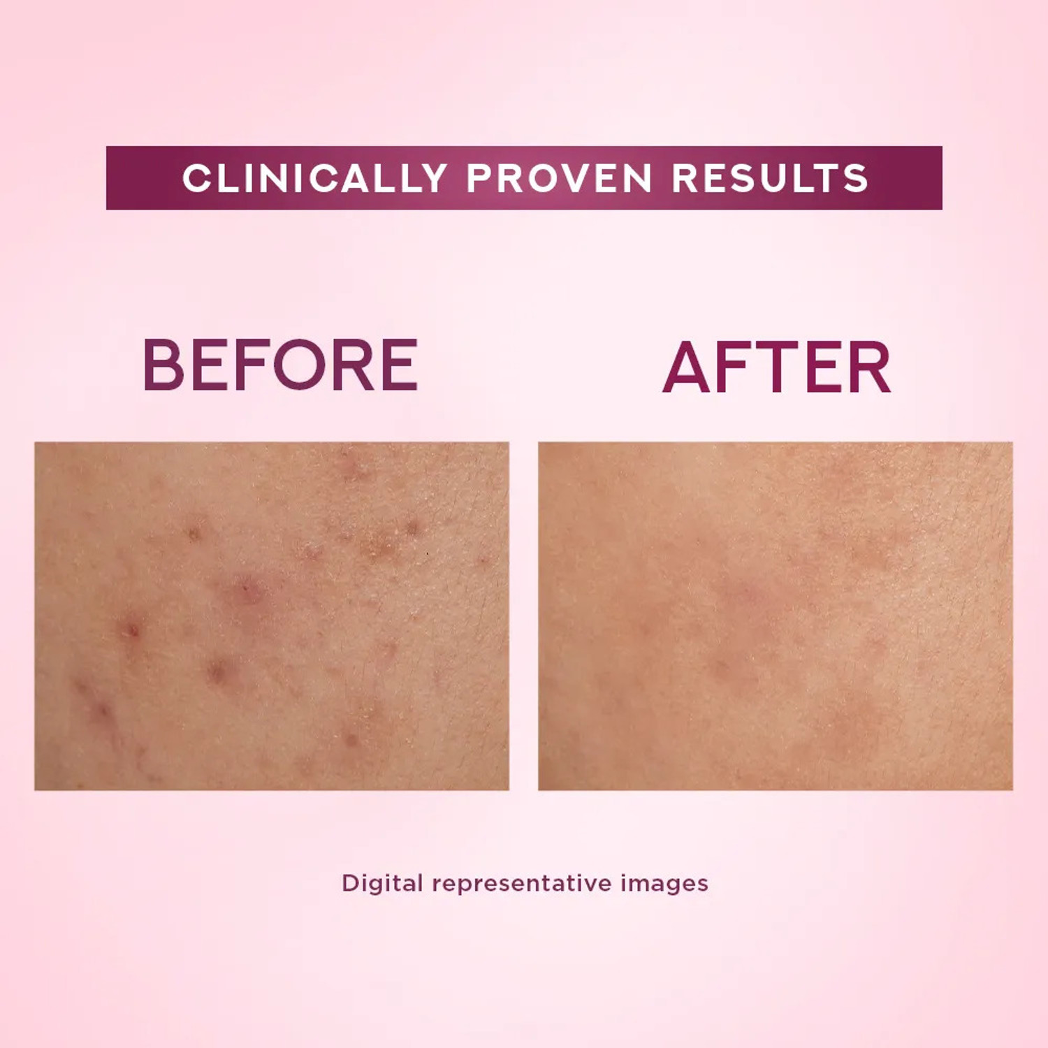 Image of POND's BRIGHT BEAUTY SPOT LESS GLOW CREAM 50ML PACK - 1