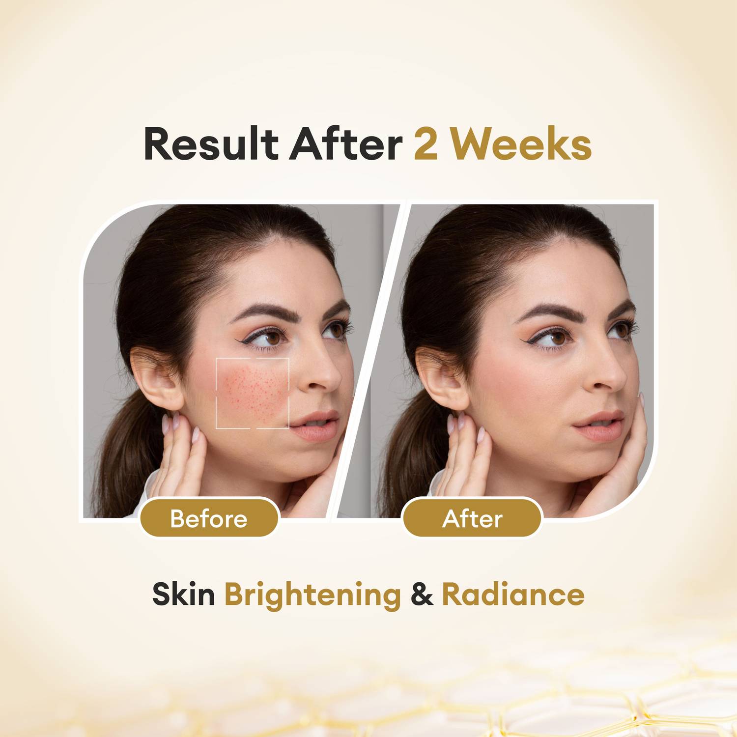 before and after glutathione cream CO Luxury Glutathione Cream with Kojic Acid,Vitamin A,C & E