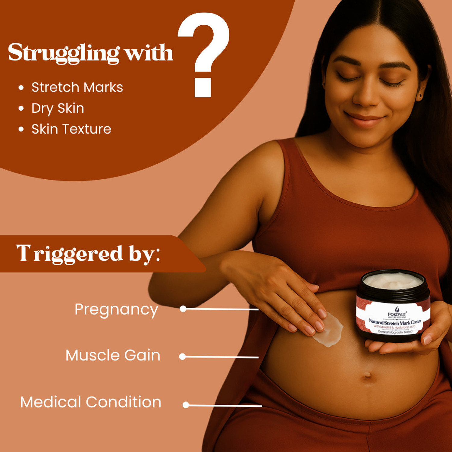 Image of Pokonut Stretch Mark Cream | Reduces Old & New Marks, Hyaluronic Acid | 50g