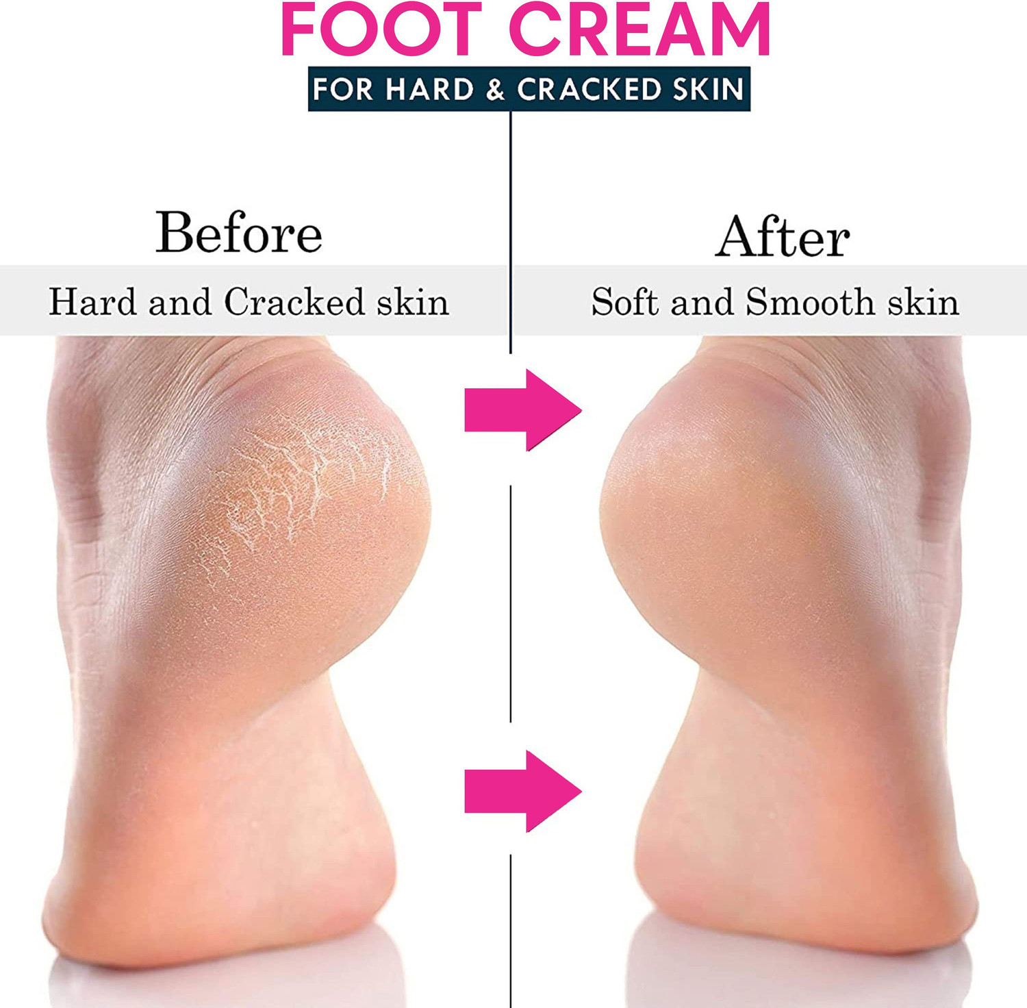 Image of AQUORAL Heel Repair Foot Crack Cream Women Men Moisurization and Hydration