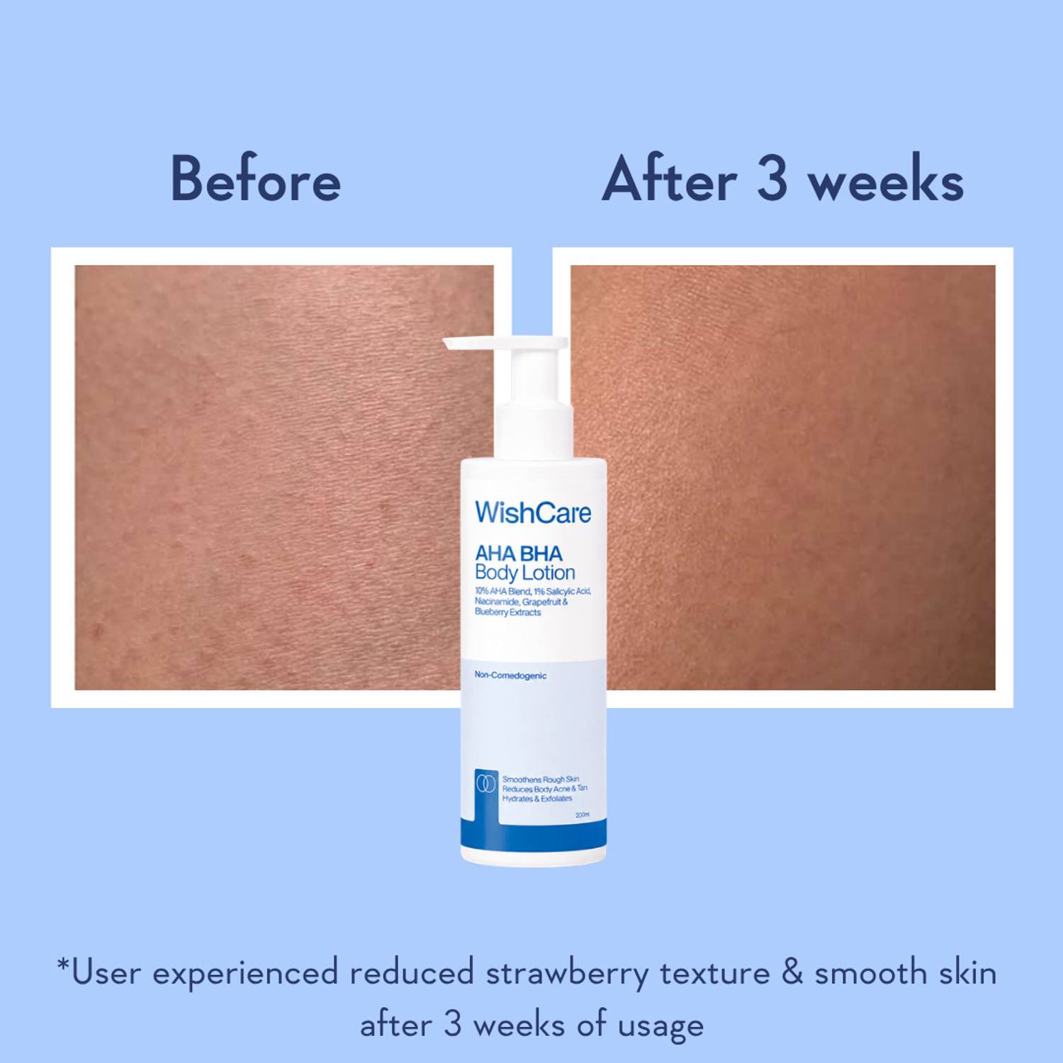WishCare AHA BHA Body Lotion For Men & Women - Image 5