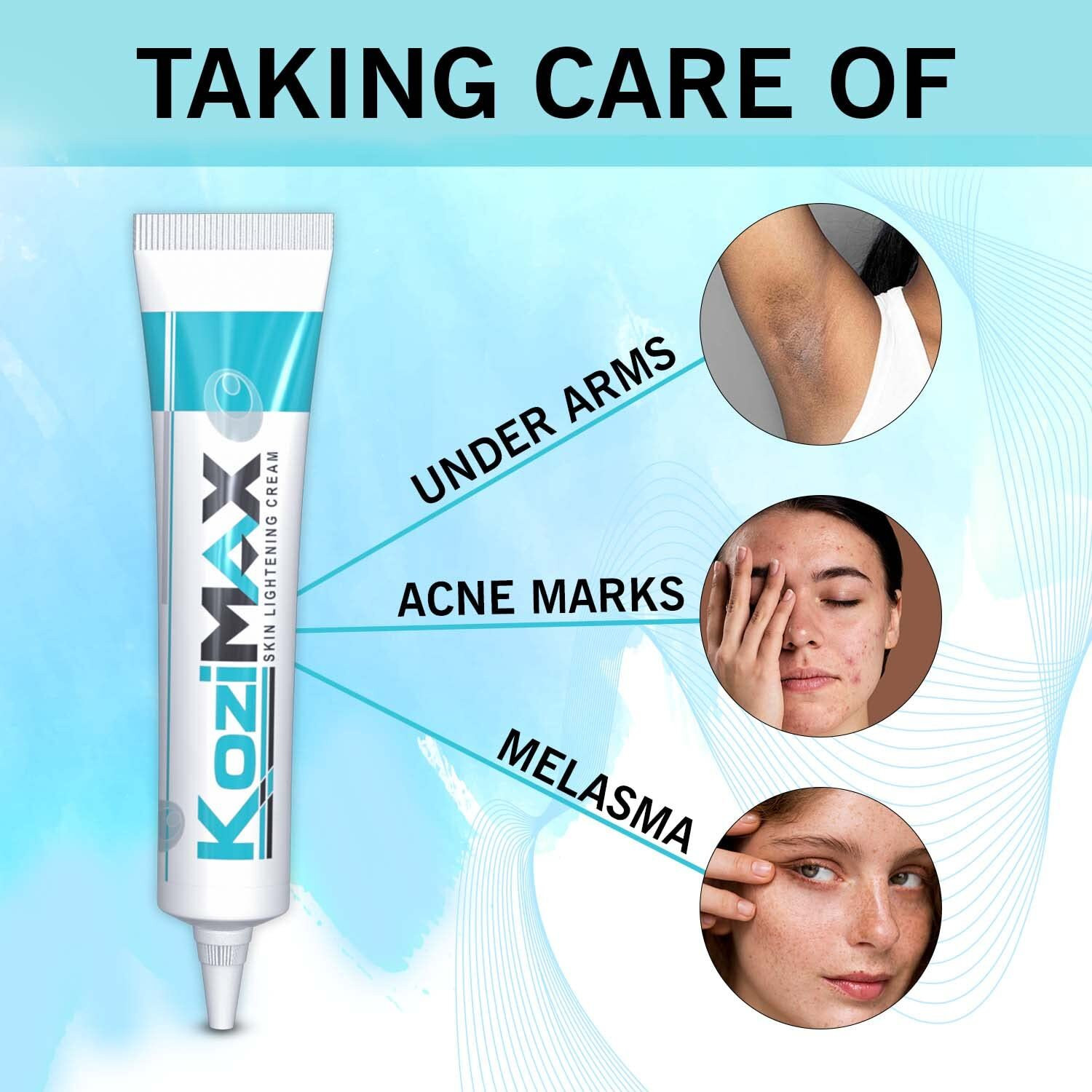 Image of KOZIMAX Skin Lightening Cream 15gm