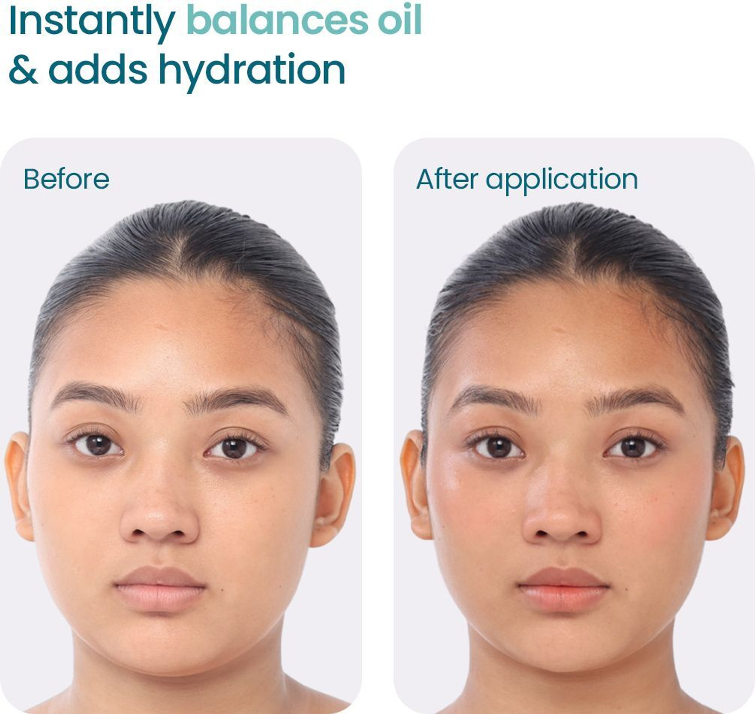 Image of WishCare 2:1:3 NMF Water Gel Moisturizer For Face|For Men & Women|Oil-Free Hydration