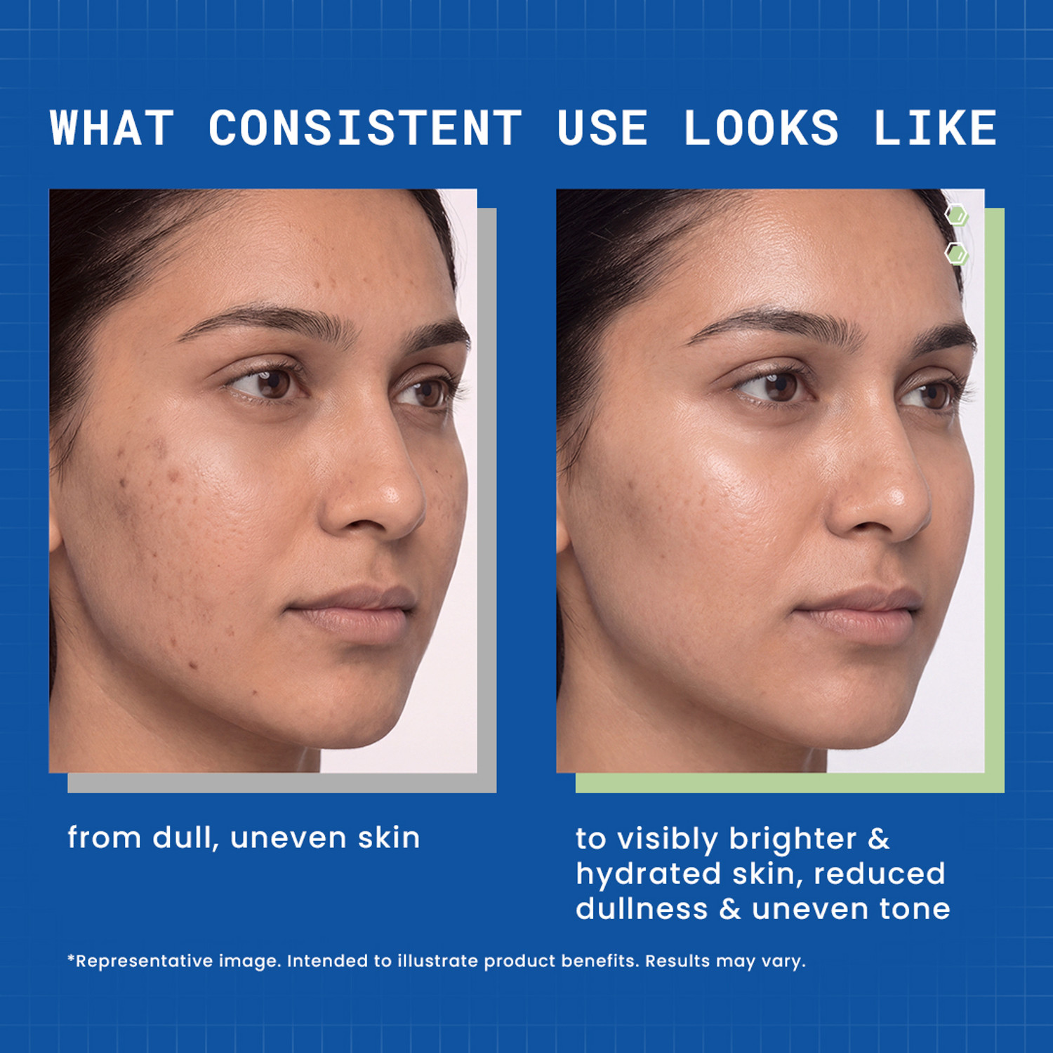 Image of DermDoc 10% Vitamin C Gel Capsule Brightening Night Cream | For Glowing Skin
