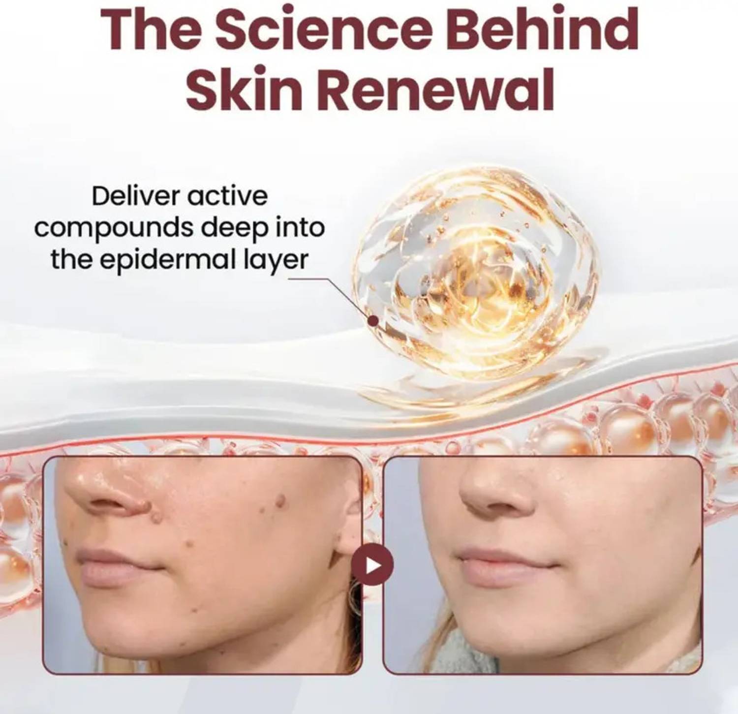 CHIWA Keraerase Dual Action Renewal Cream | For Refined Daily