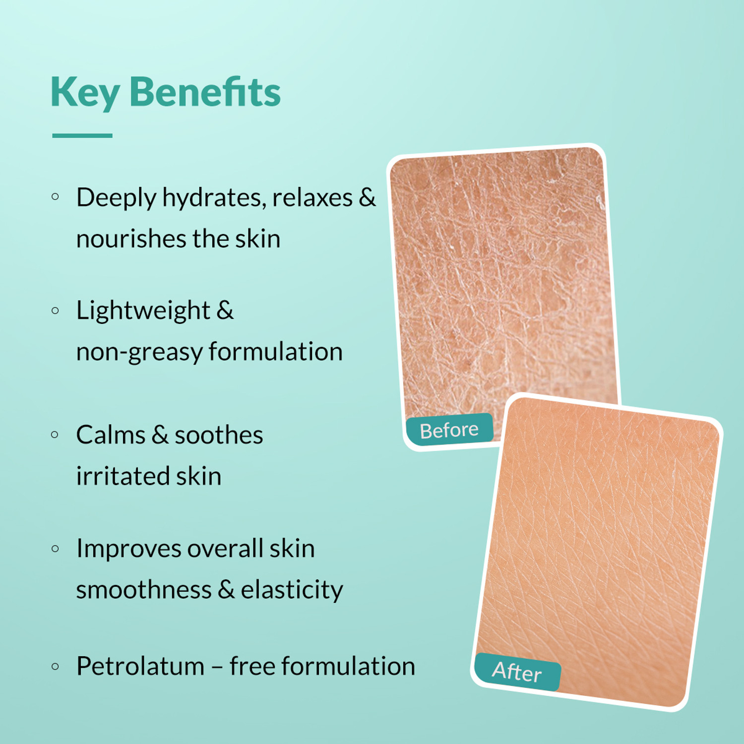 Image of Fixderma Dewrav Moisturizing Cream for Face & Body Deeply Hydrates Dry to Very Dry Skin