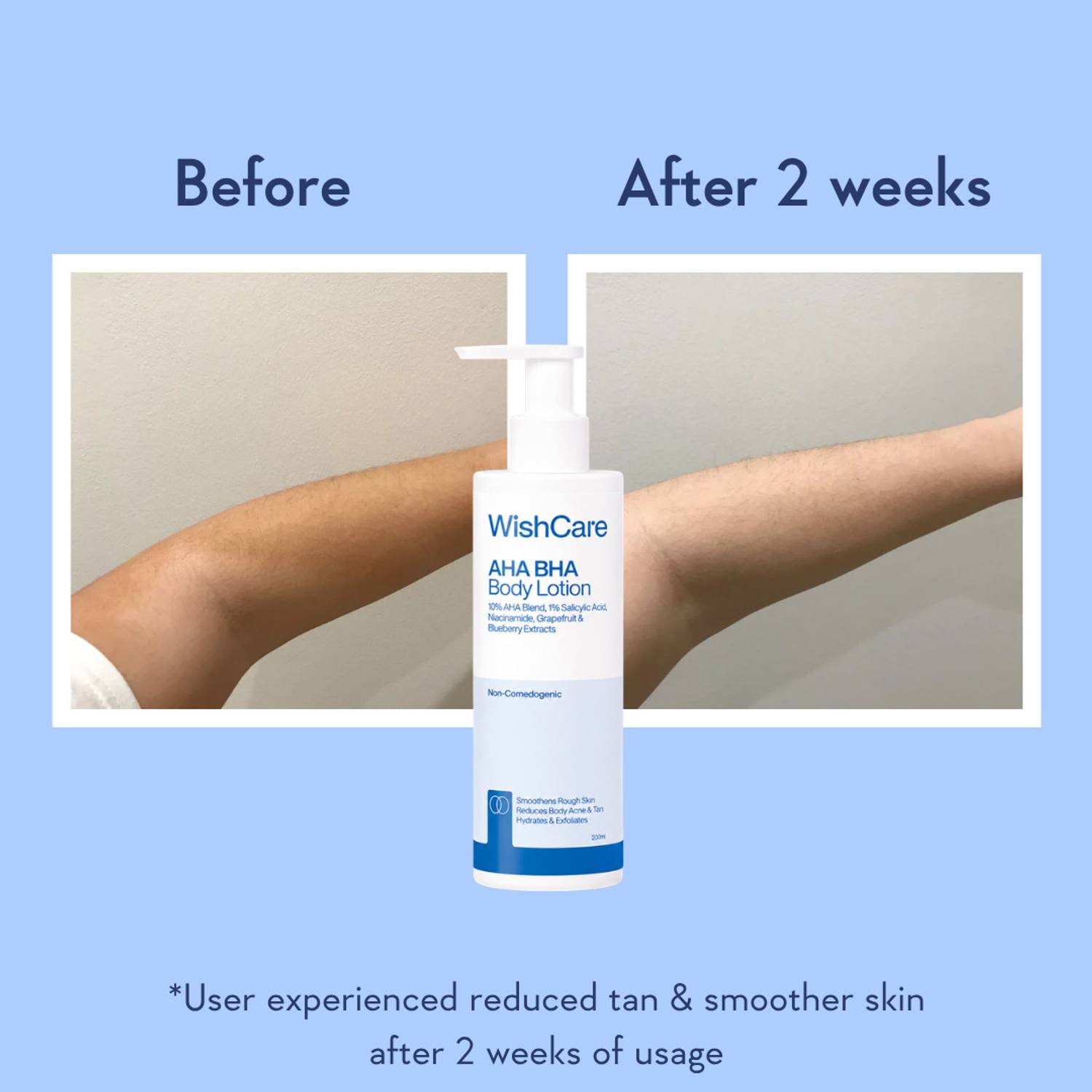 WishCare AHA BHA Body Lotion For Men & Women - Image 4