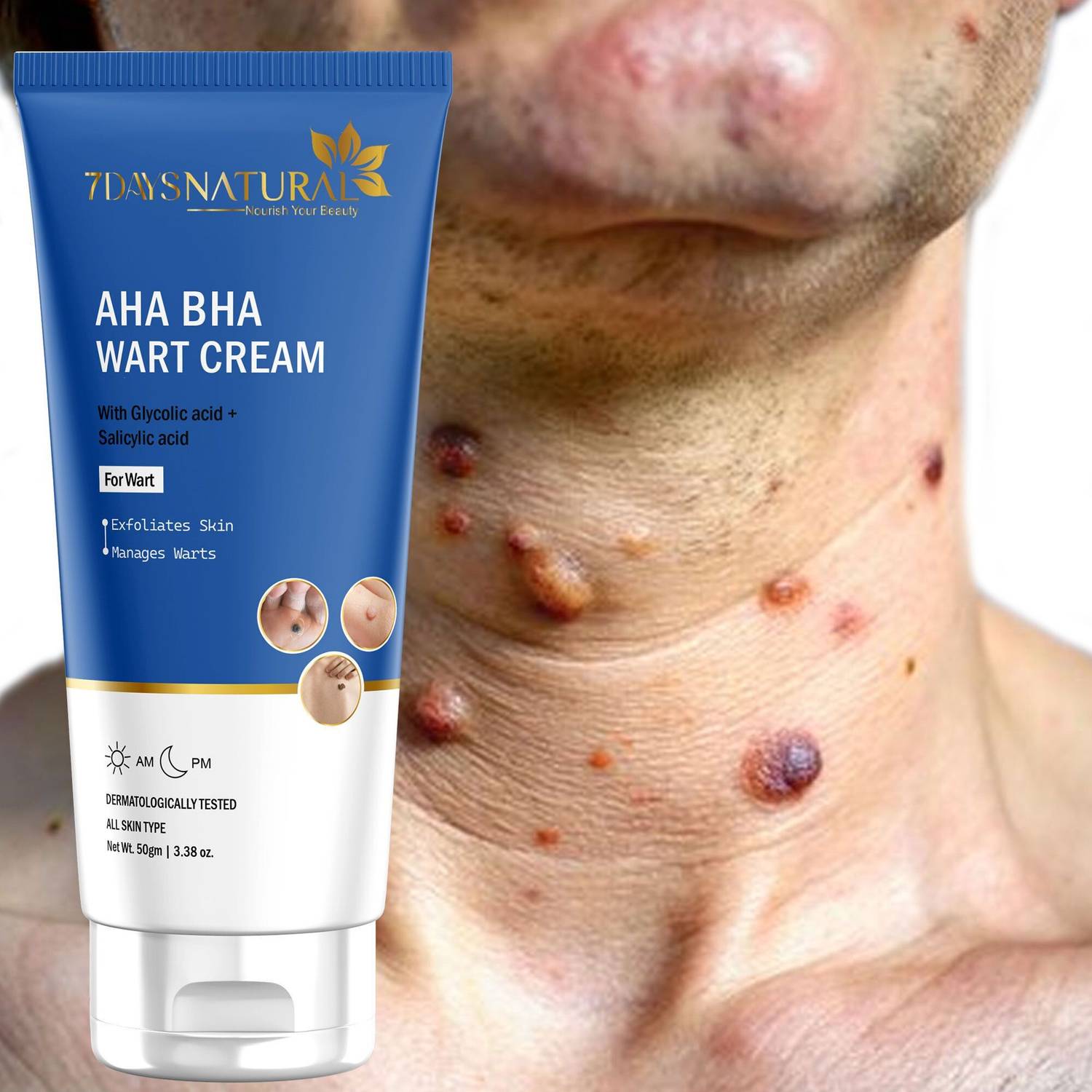 7days natural AHA BHA Wart Removal Cream – Advanced Skin Treatment – Pack Of 1 - 50g