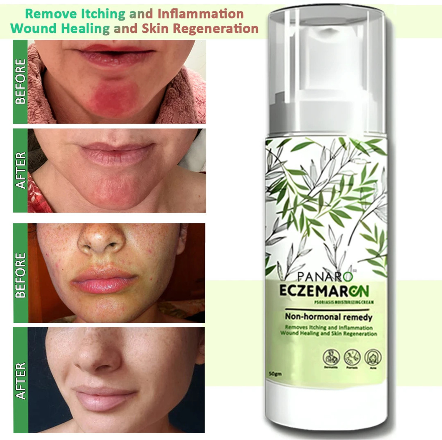 Image of PANARO Eczemar On Anti Fungal Cream For Men & Women