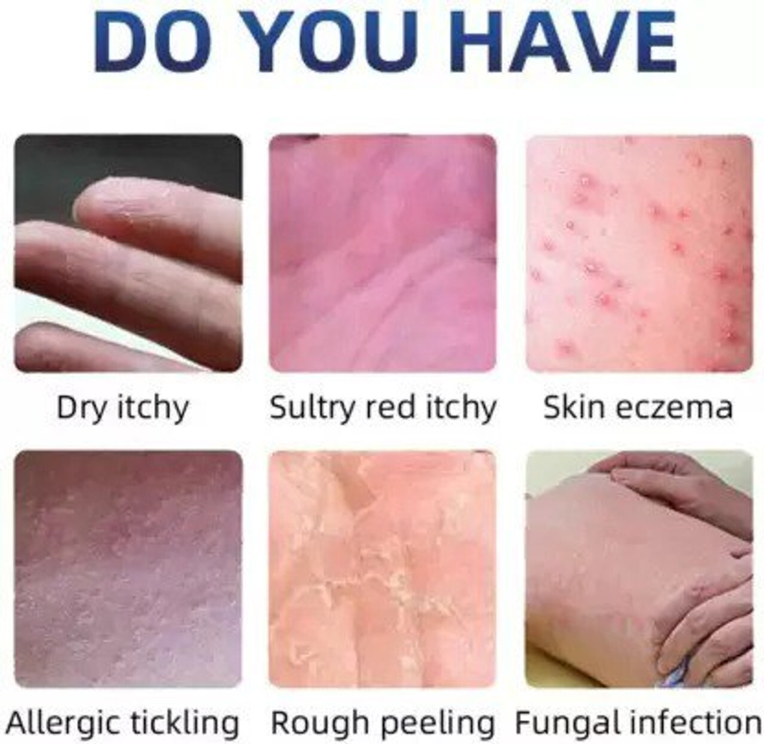 Image of Ontario ECZEMA CREAM MEN & WOMEN AX4.42 (PACK OF 1)