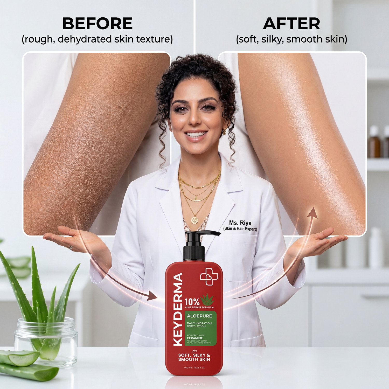 Image of Keyderma Aloepure Body Lotion | Ceramide , AHA BHA , Amino Peptide | ALOE VERA 10%