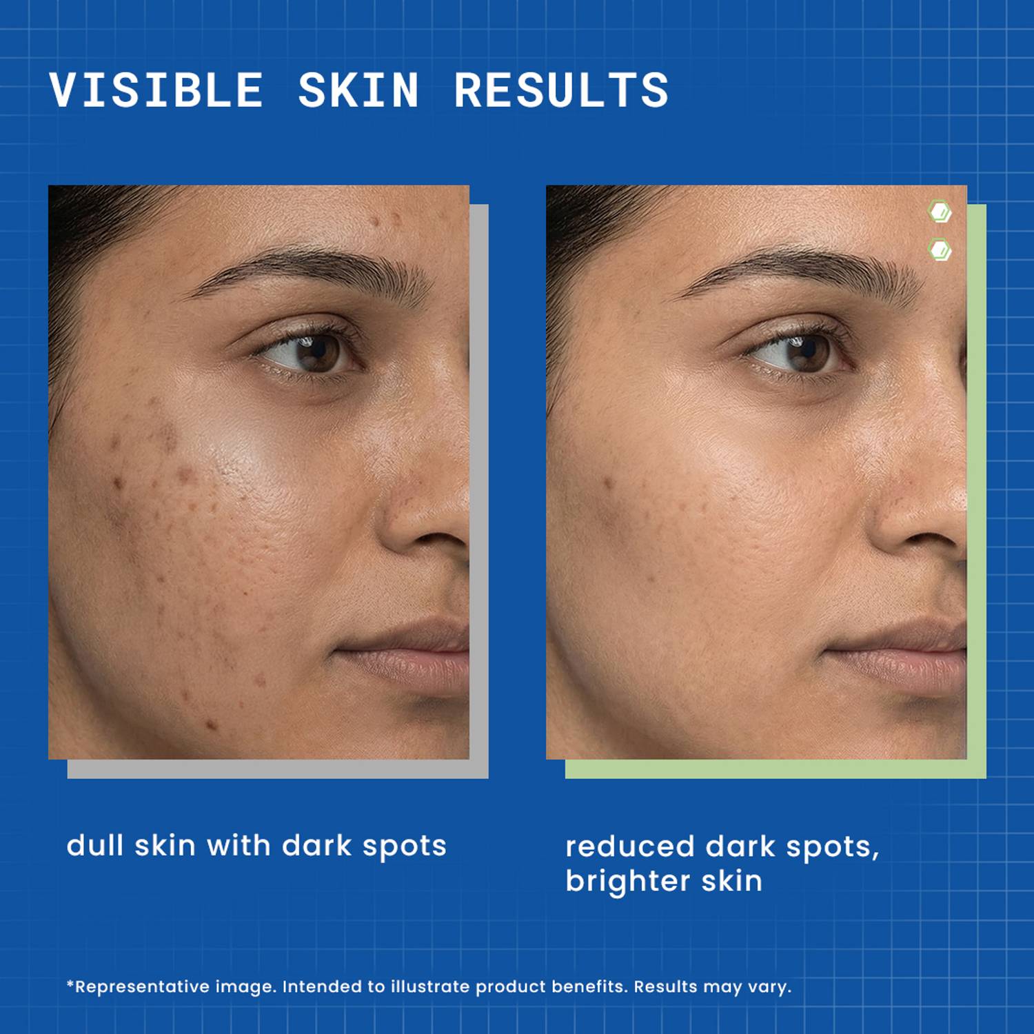 DermDoc 2% Kojic Acid Night Cream - Image 2
