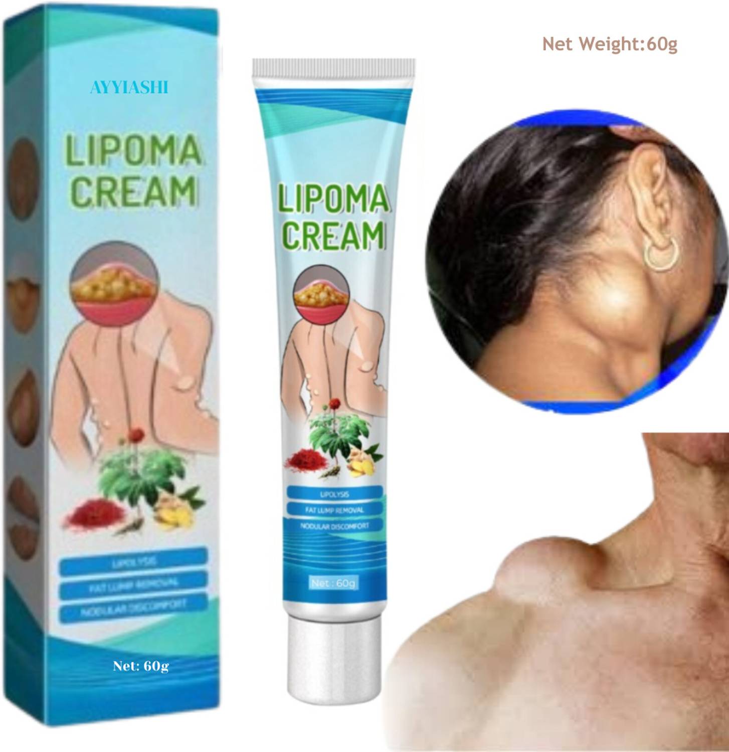 AYYIASHI Lipoma Cream – Herbal Support For Skin Health - Price in