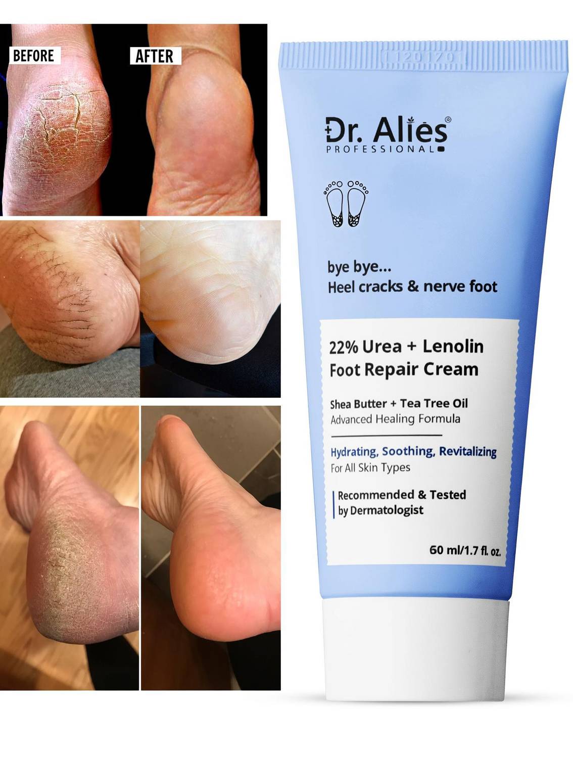 Dr. Alies Professional 22% Urea Foot Care Cream, 100g - Image 1