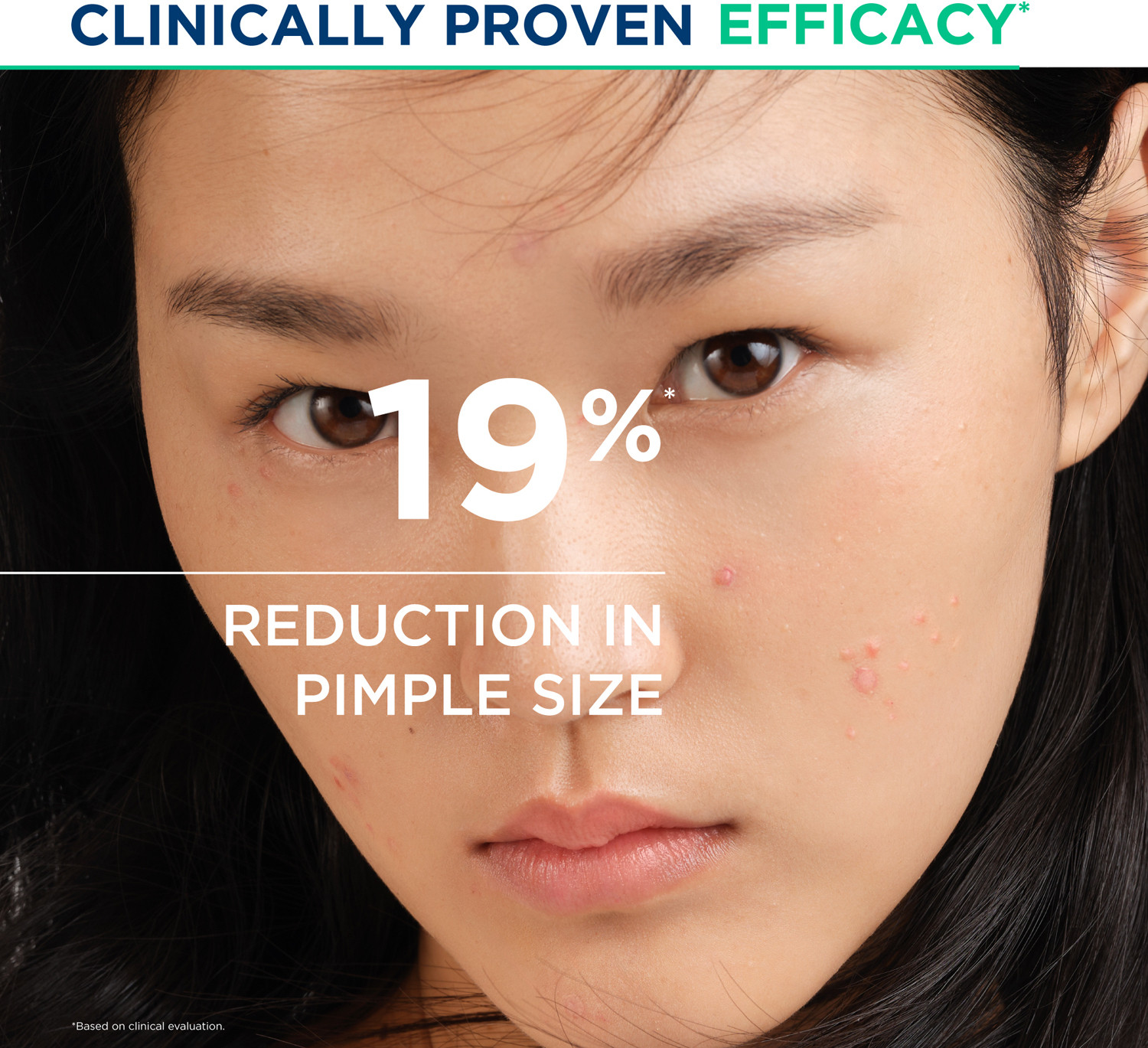 Image of BIODERMA Sebium Kerato+ Anti-Blemish, Anti-Marks Gel Cream