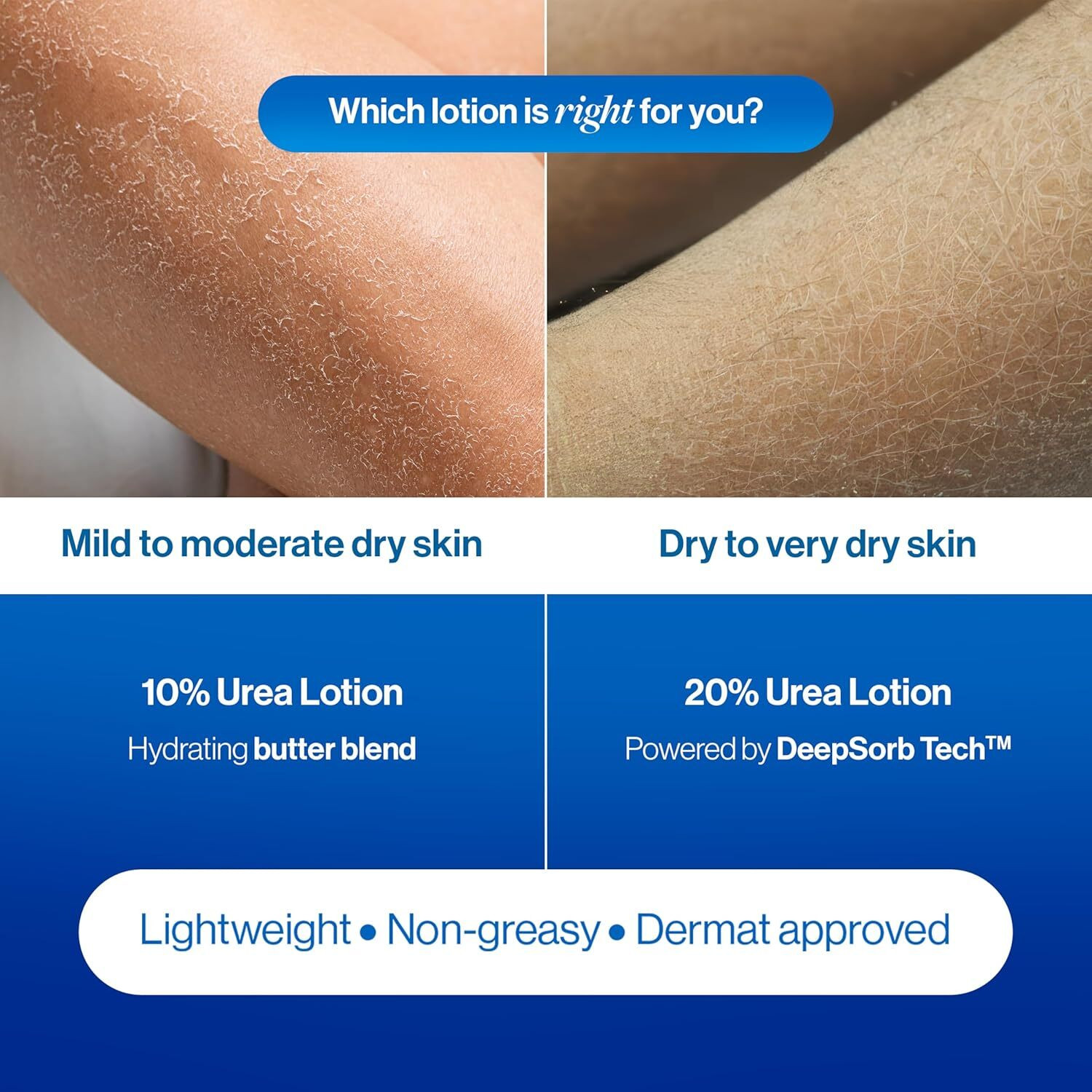 Image of Be Bodywise 20% Urea Body Lotion for Very Dry & Flaky Skin Repair |48H Hydration| 300 ml x 2