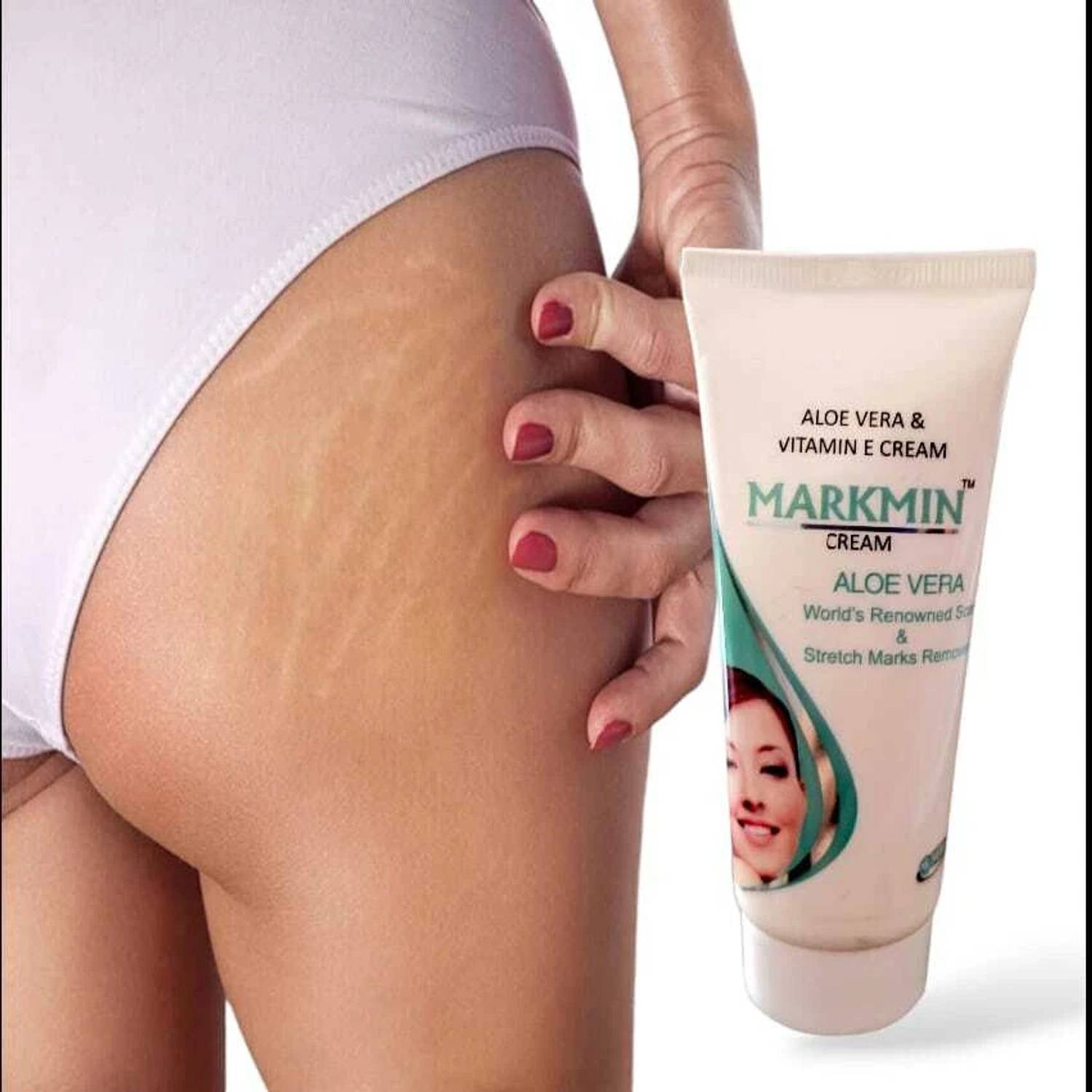 ZEE DRUGS Markmin Stretch Marks Removal Cream With Aloe Vera & Vit. E (Pack  of 2) 60g Each