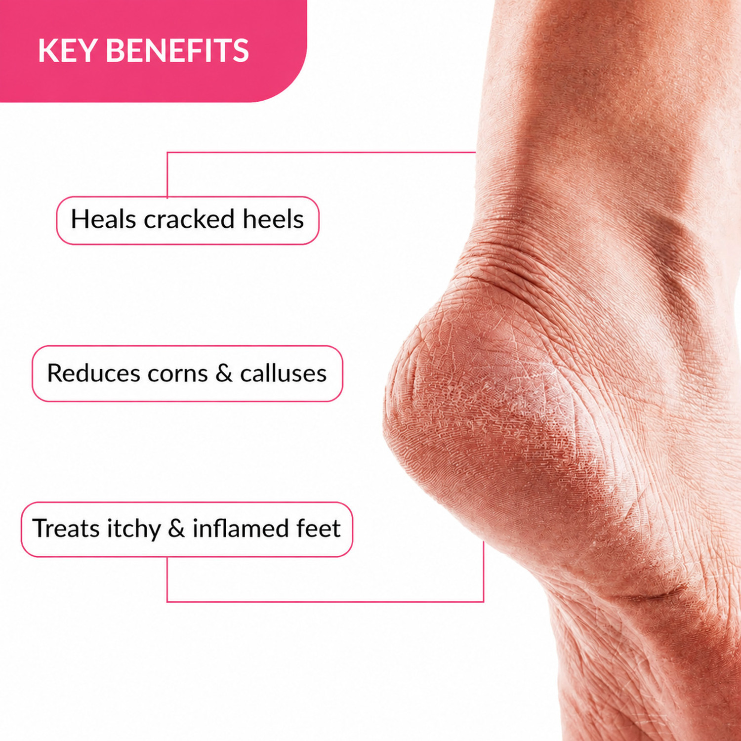 Image of Refollium Feet crack heel repair cream Smooth Foot Crack Cracked Heel Repari Foot Cream