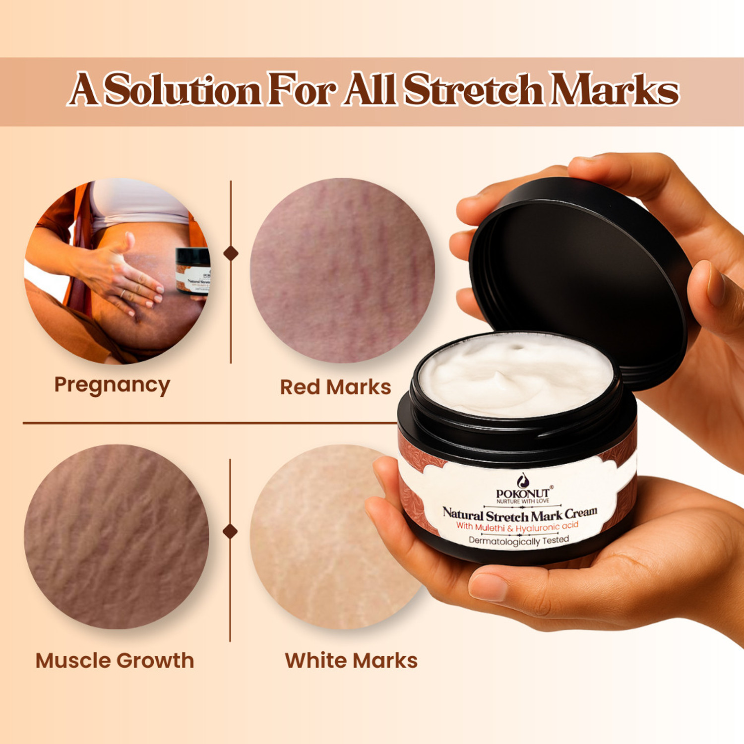 Image of Pokonut Stretch Mark Repair Combo, Cream & Roll-On Serum