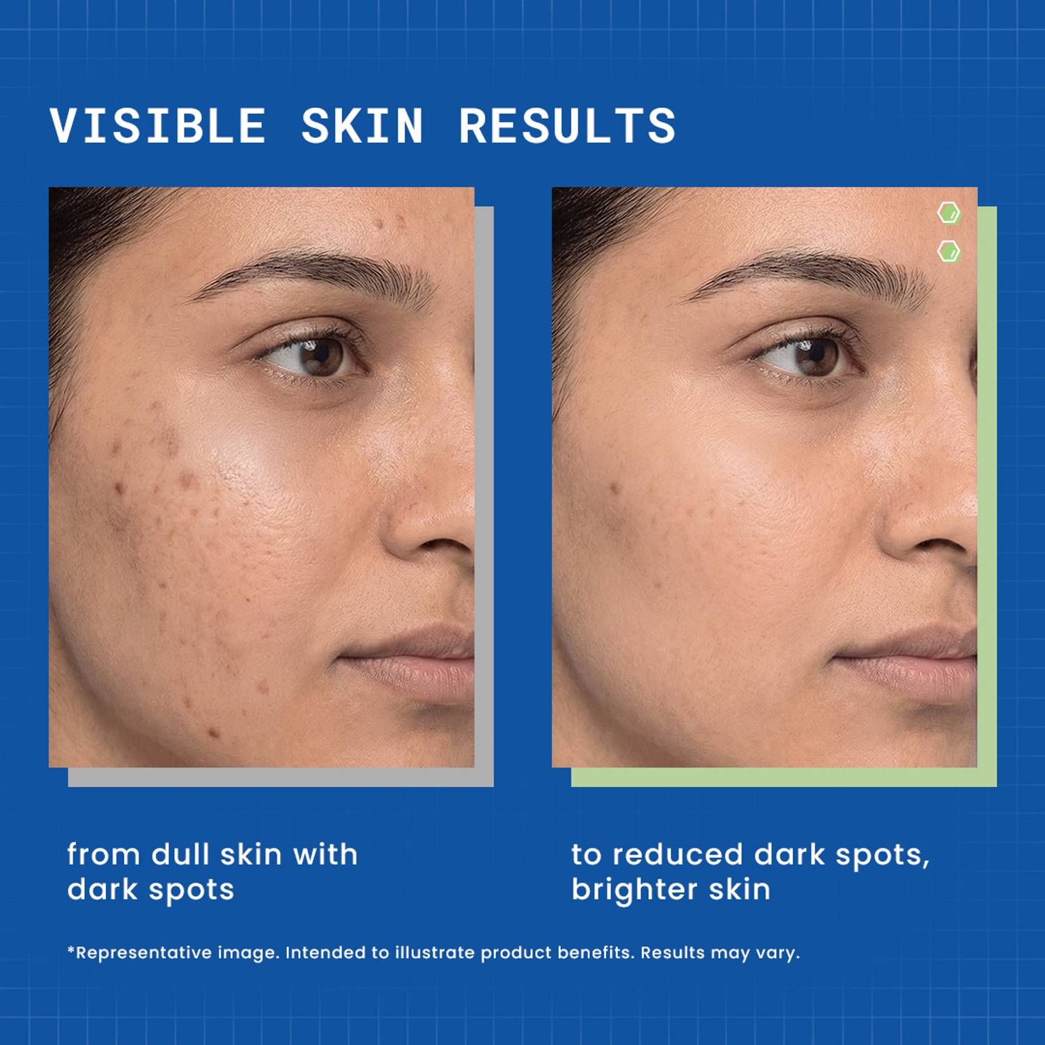 DermDoc 2% Kojic Acid Night Cream - Image 2