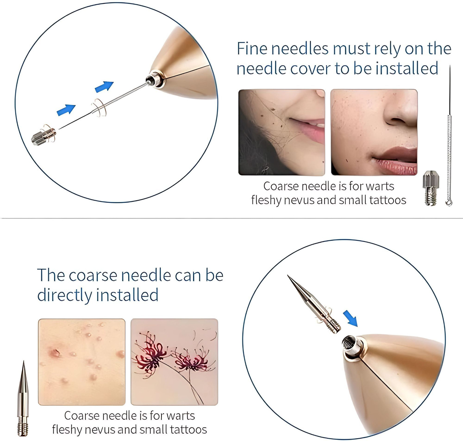 Image of Kostech 9 Level Laser Mole Removal Sweep Spot Pen| Mole Tattoo Wart Remover Mucus Removal Device