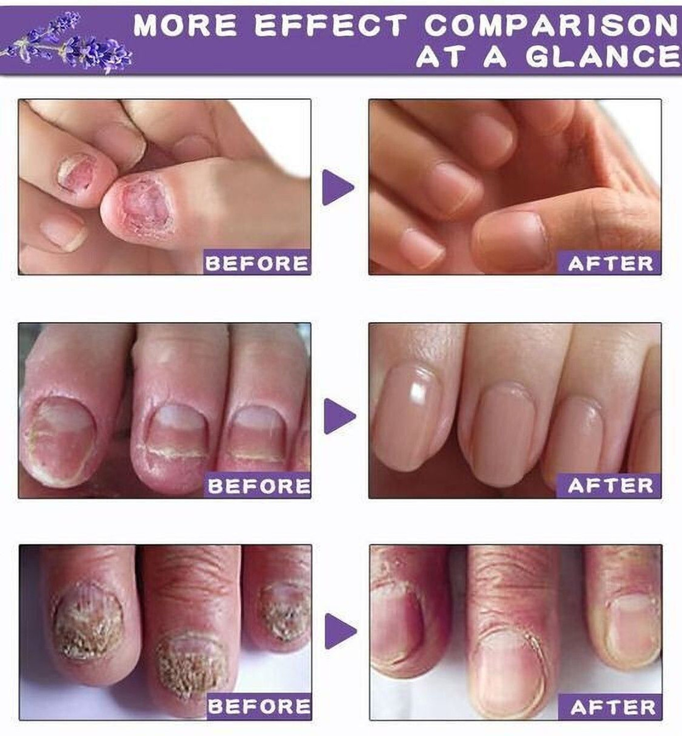 Image of Edith Nail growth oil fast, nail strong oil, nail strong serum