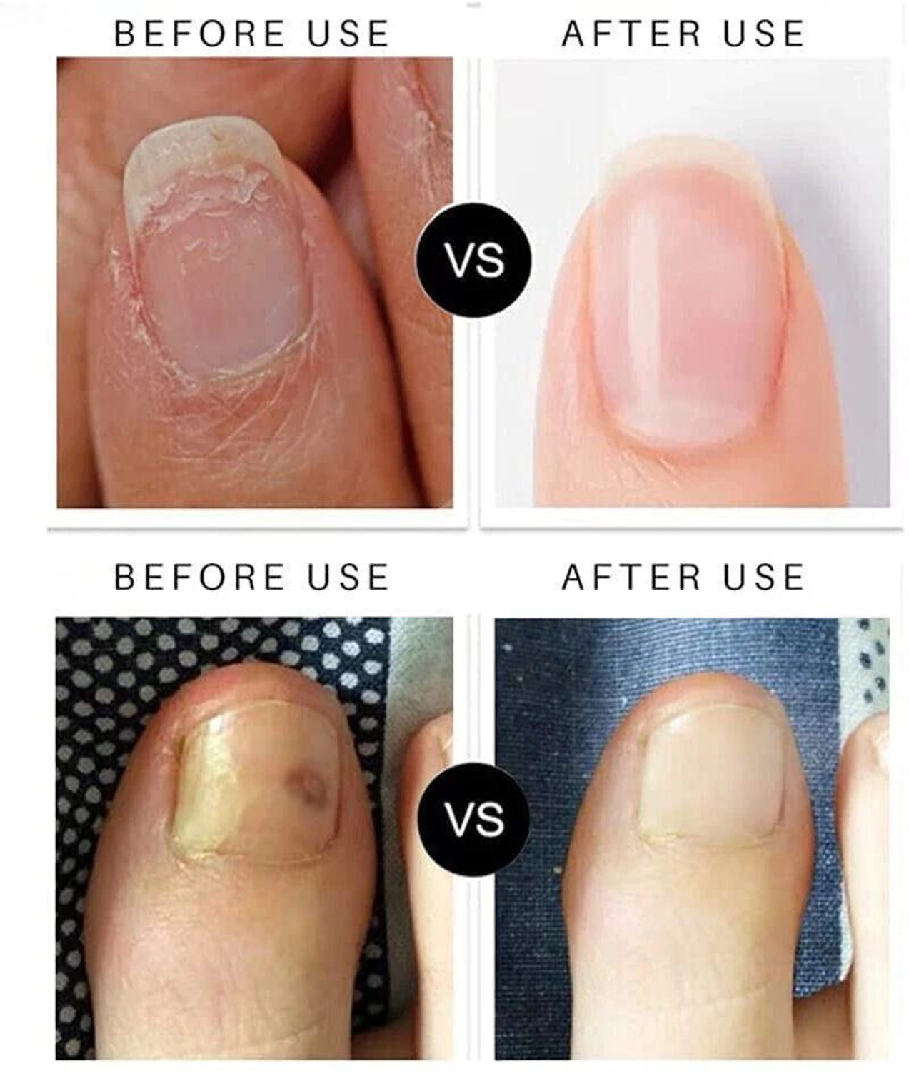 Image of Edith Nail growth oil fast, nail strong oil, nail strong serum
