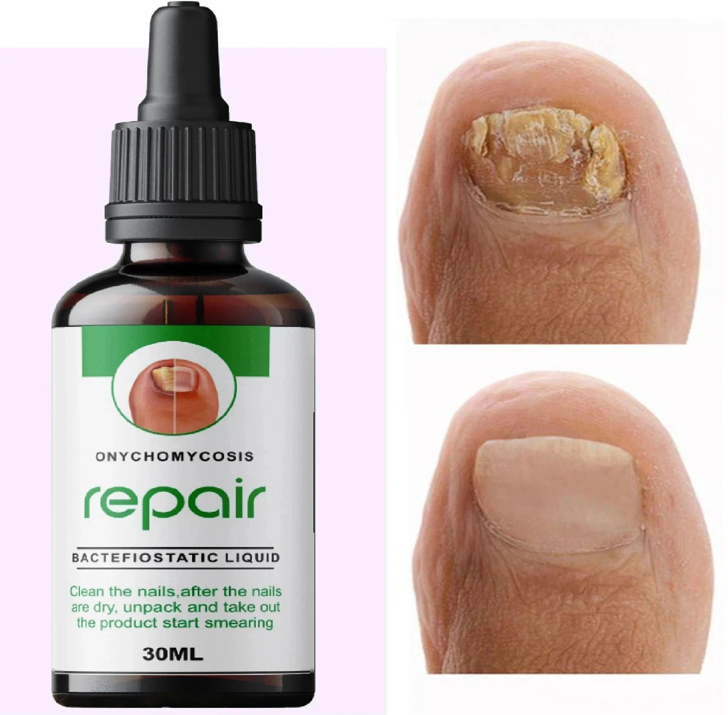 Image of Edith Nail growth oil fast, nail strong oil, nail strong serum