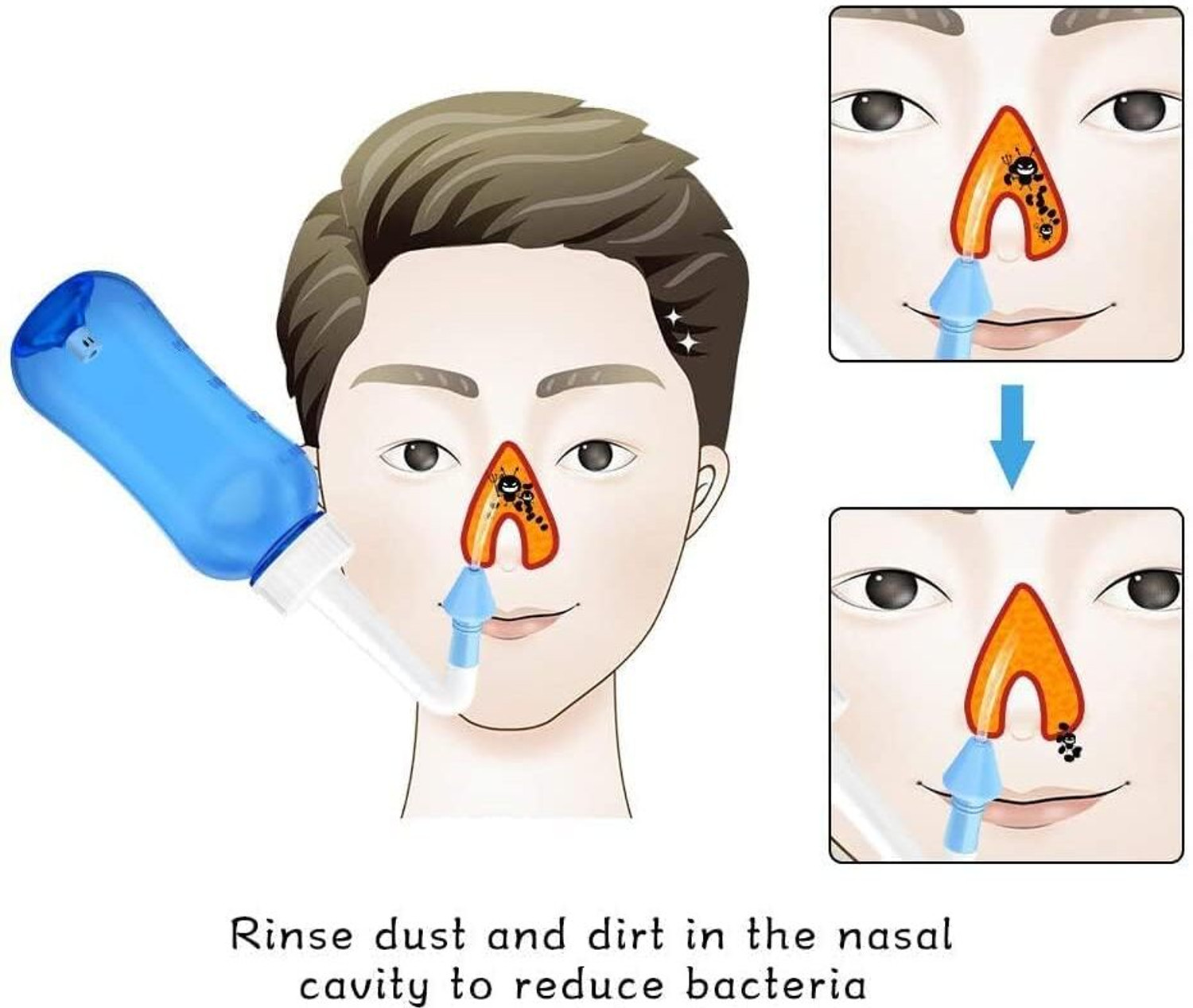 Image of JUDEE Plastic Blue Neti Pot