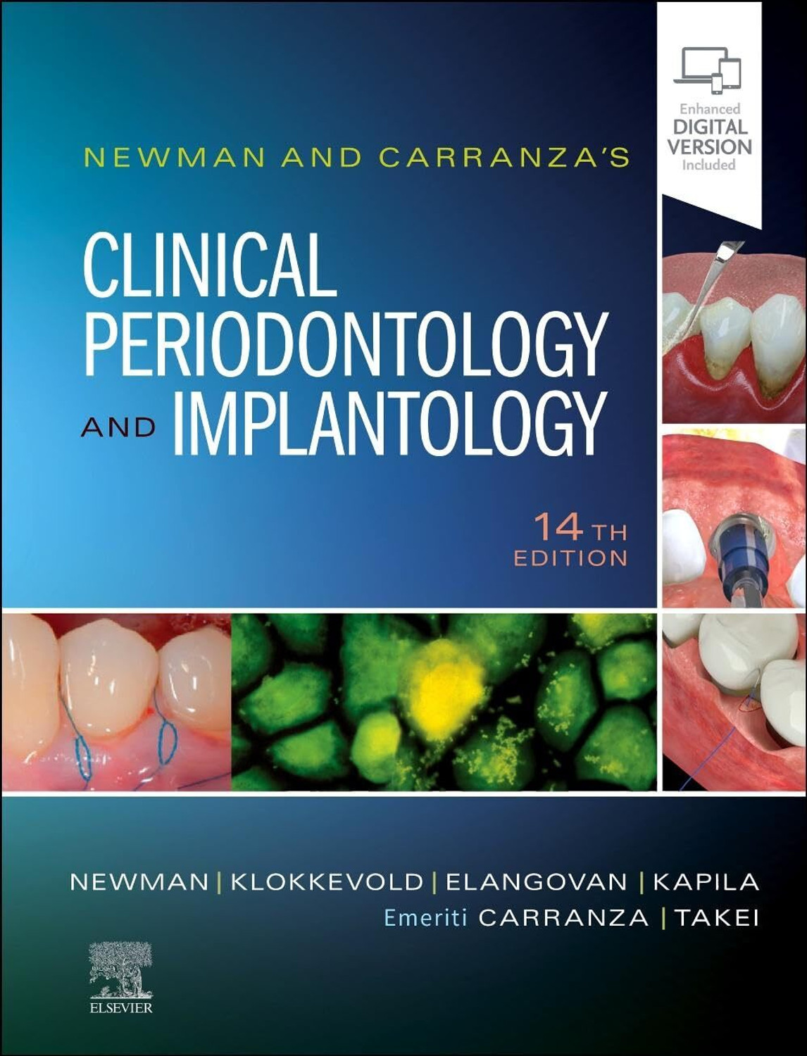 Image of Newman And Carranzas Clinical Periodontology And Implantology With Medical Use Note Book 1000 Pages (HARDCOVER +SPIRAL BINDING, ewman)