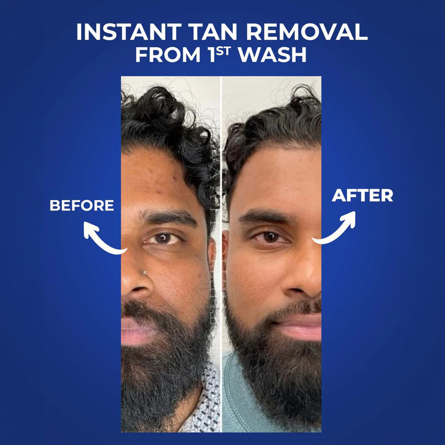 Image of Aqueria De-Tan Peel Shot with Niacinamide, Rice Water & Lactic Acid Tan Removal Scrub