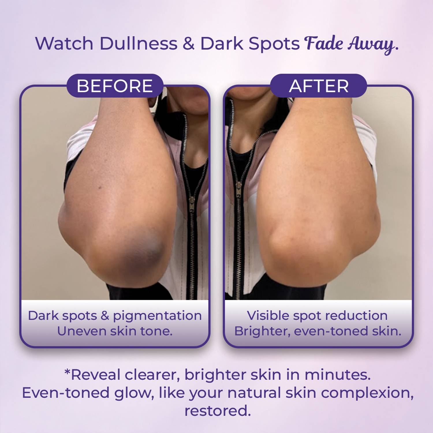 Sanfe Instant Spotlite Mask - Tan Removal - Image 2