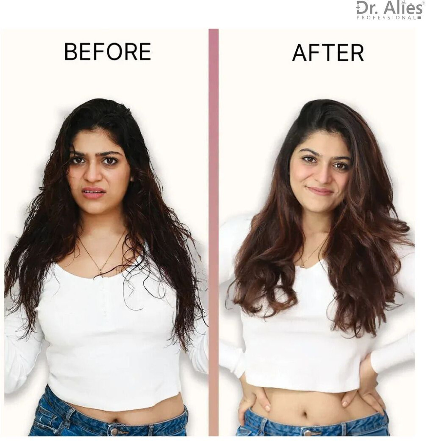 Image of Dr. Alies Professional Anti-Dandruff Shampoo - Upto 100% Dandruff Reduction with Salicylic Acid, Biotin