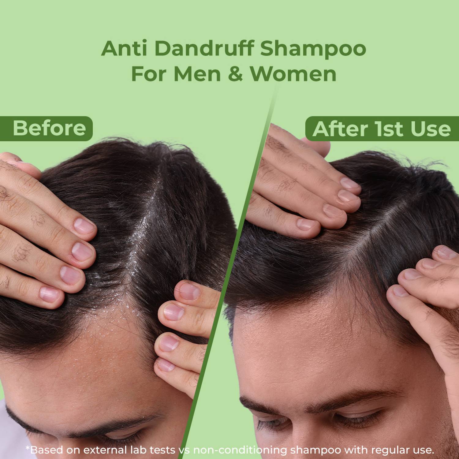 Naturali Anti Dandruff Shampoo 370ml - Image 3