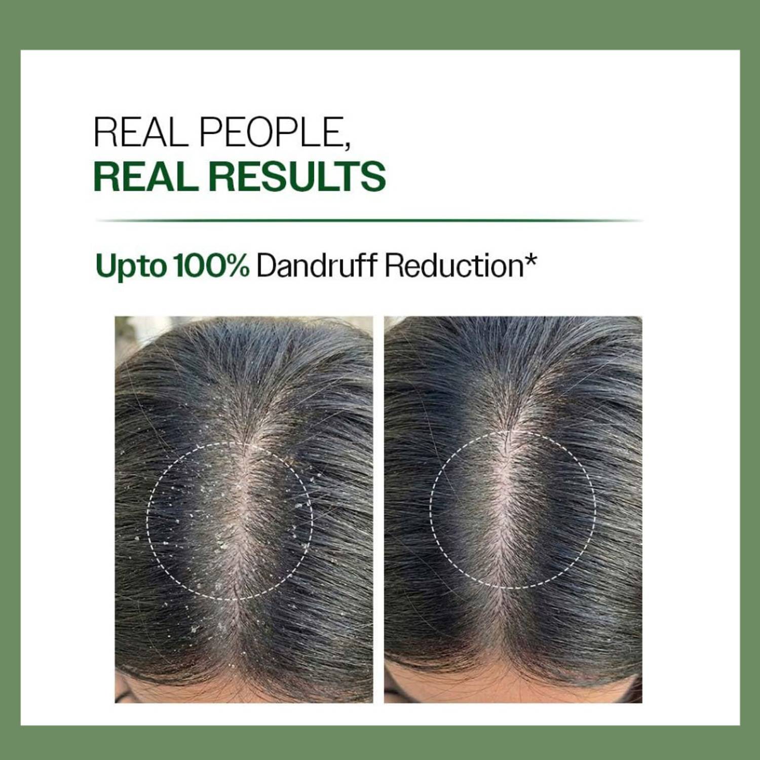 YeoJi Anti-Dandruff Shampoo for Oily Scalp 250 ml - Image 3